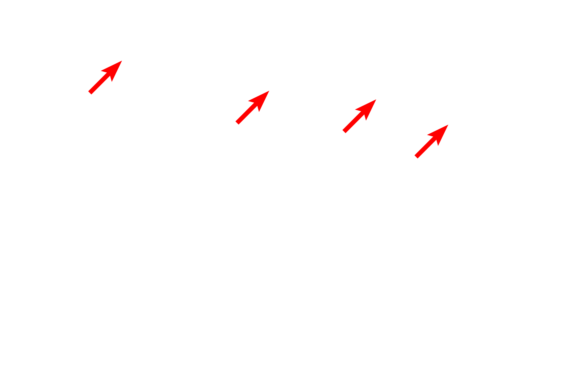 Blood vessels <p>Another image of the trachea or primary bronchus demonstrates the components forming the wall of these passageways. The large number of blood vessels, particularly in the lamina propria, serve to warm the inspired air. 100x</p>
