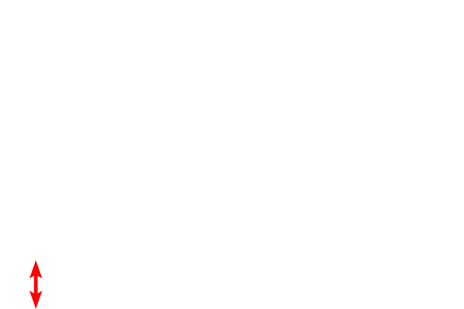 Hyaline cartilage <p>Another image of the trachea or primary bronchus demonstrates the components forming the wall of these passageways. The large number of blood vessels, particularly in the lamina propria, serve to warm the inspired air. 100x</p>
