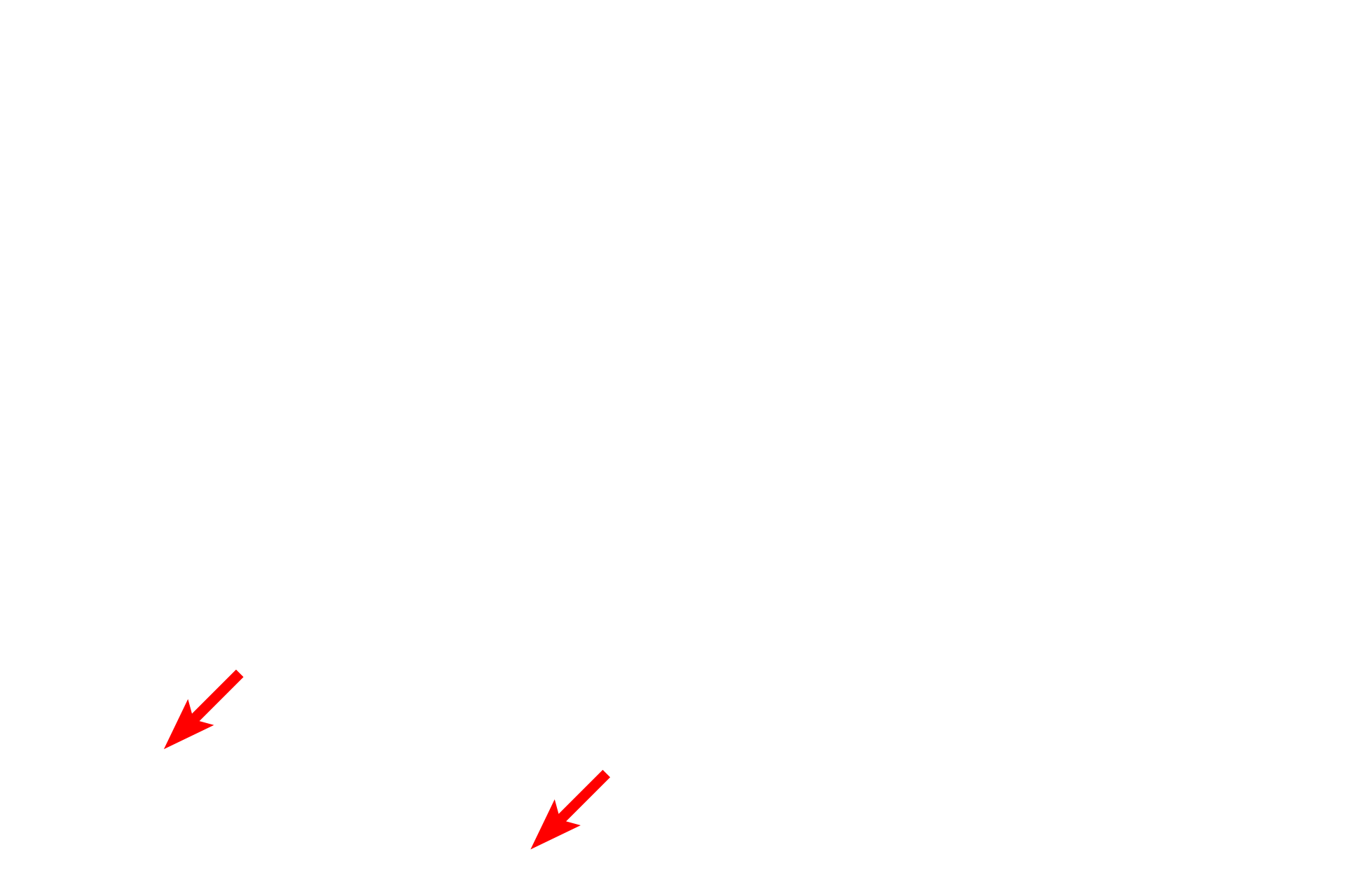 Perichondrium <p>Another image of the trachea or primary bronchus demonstrates the components forming the wall of these passageways. The large number of blood vessels, particularly in the lamina propria, serve to warm the inspired air. 100x</p>
