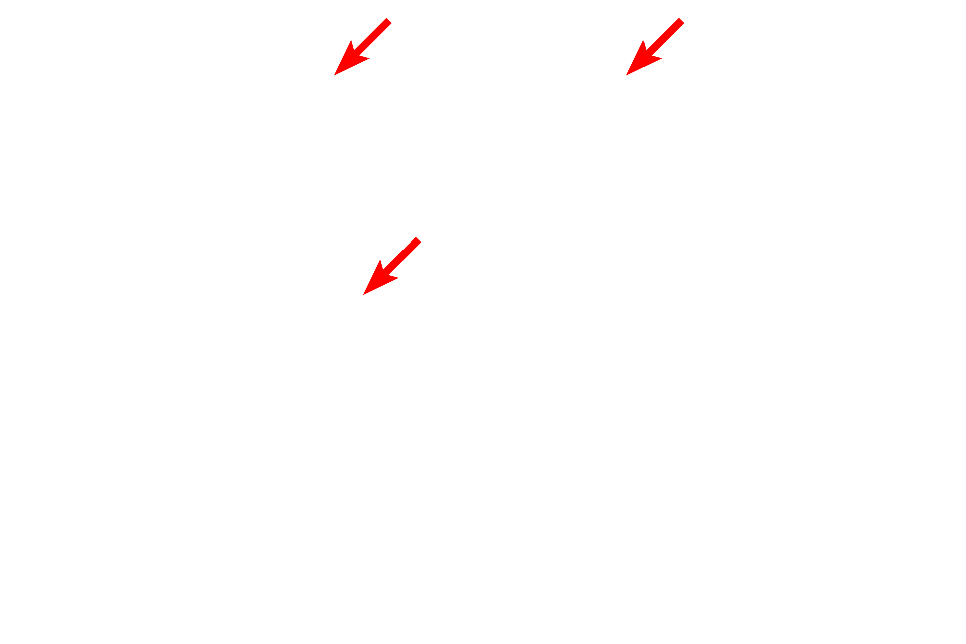 Cilia <p>The epithelium lining the trachea and primary bronchi is respiratory epithelium, pseudostratified columnar with cilia and goblet cells. The basement membrane is frequently prominent beneath this epithelium. 1000x</p>
