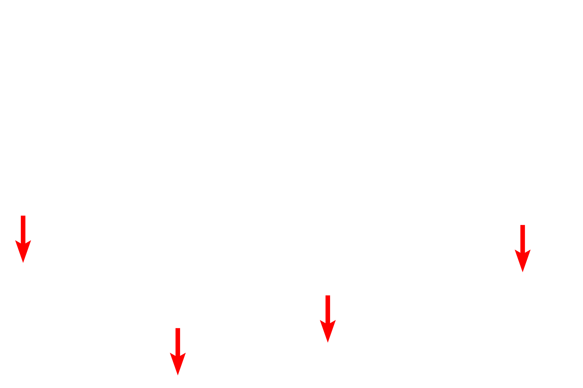 Basement membrane <p>The epithelium lining the trachea and primary bronchi is respiratory epithelium, pseudostratified columnar with cilia and goblet cells. The basement membrane is frequently prominent beneath this epithelium. 1000x</p>
