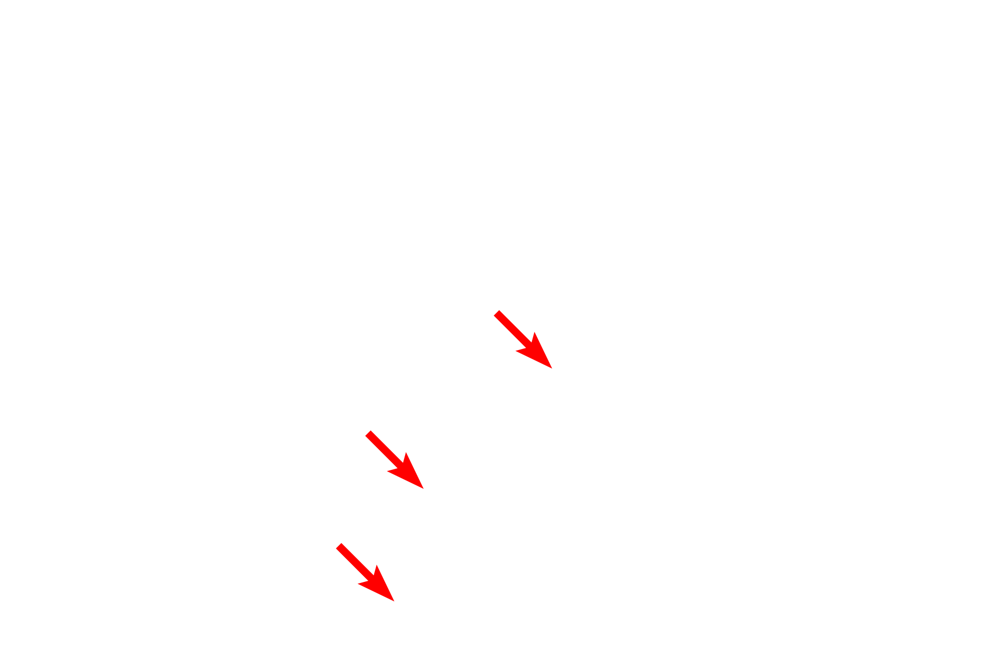  - Mucin granules <p>An electron micrograph shows the surface of the respiratory epithelium. The expanded upper portion of a goblet cell is visible along with the ciliated epithelial cells. Goblet cells release mucus onto the surface where it traps inhaled particulate matter. Rhythmic beating of the cilia move the layer of mucus upwards, to be swallowed or coughed out. This mechanism is often referred to as the “muco-ciliary escalator”.  8000x</p>
