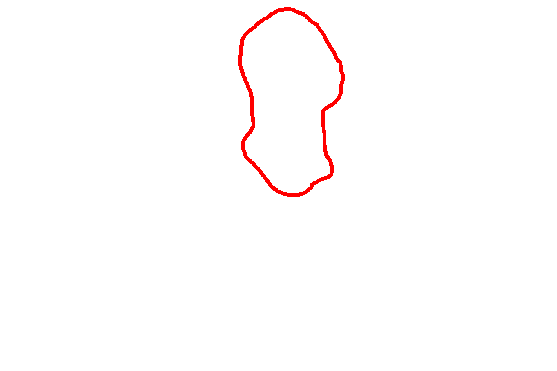  - Mucus <p>An electron micrograph shows the surface of the respiratory epithelium. The expanded upper portion of a goblet cell is visible along with the ciliated epithelial cells. Goblet cells release mucus onto the surface where it traps inhaled particulate matter. Rhythmic beating of the cilia move the layer of mucus upwards, to be swallowed or coughed out. This mechanism is often referred to as the “muco-ciliary escalator”.  8000x</p>
