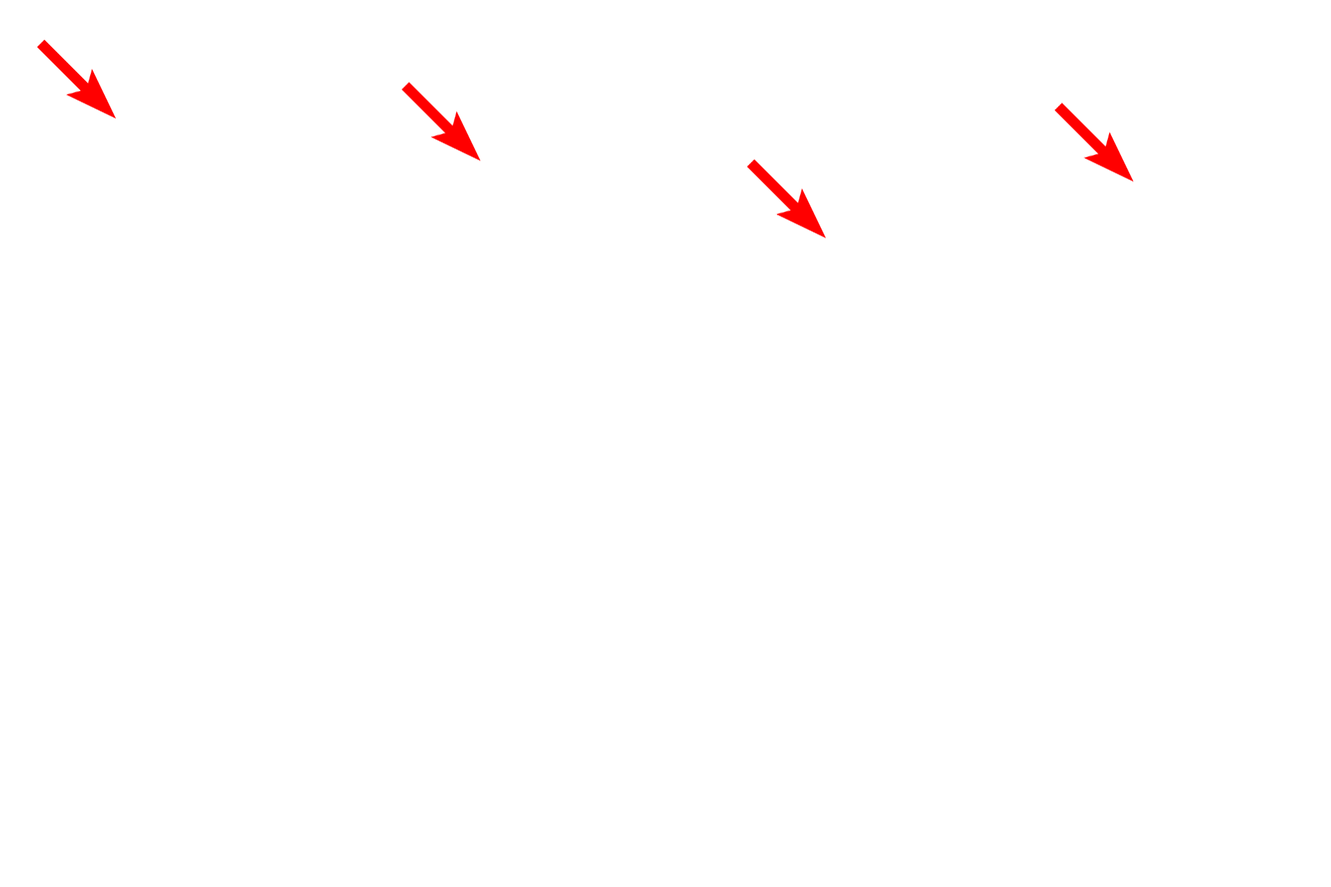  - Cilia <p>An electron micrograph shows the surface of the respiratory epithelium. The expanded upper portion of a goblet cell is visible along with the ciliated epithelial cells. Goblet cells release mucus onto the surface where it traps inhaled particulate matter. Rhythmic beating of the cilia move the layer of mucus upwards, to be swallowed or coughed out. This mechanism is often referred to as the “muco-ciliary escalator”.  8000x</p>

