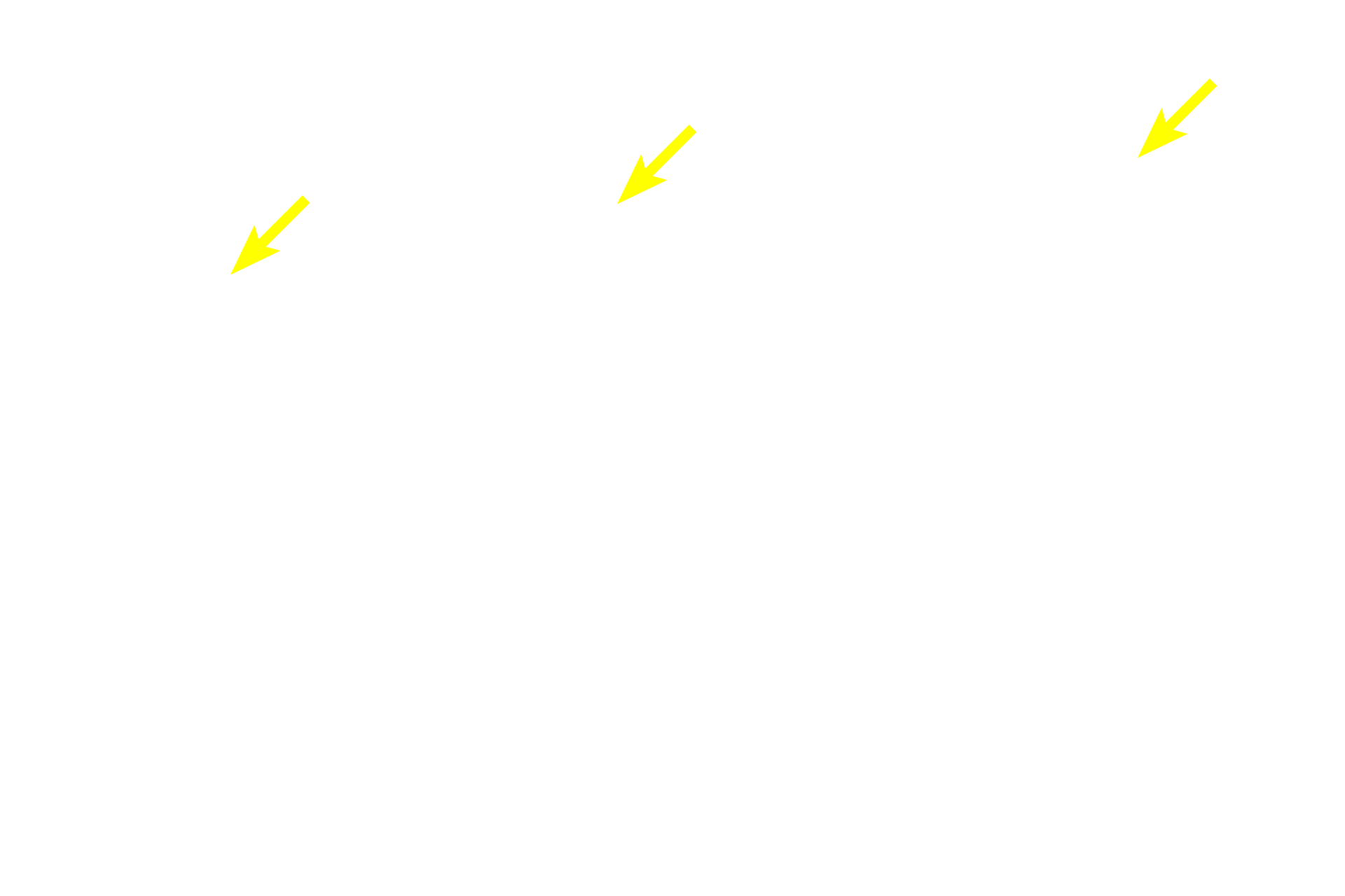 Basement membrane <p>Beneath the lamina propria, elastic fibers become more numerous forming a distinct elastic lamina, separating the lamina propria and submucosa. The elastic lamina provides structural support to maintain patency and also allows for expansion and passive recoil during the inhalation-exhalation cycle. 200x</p>

