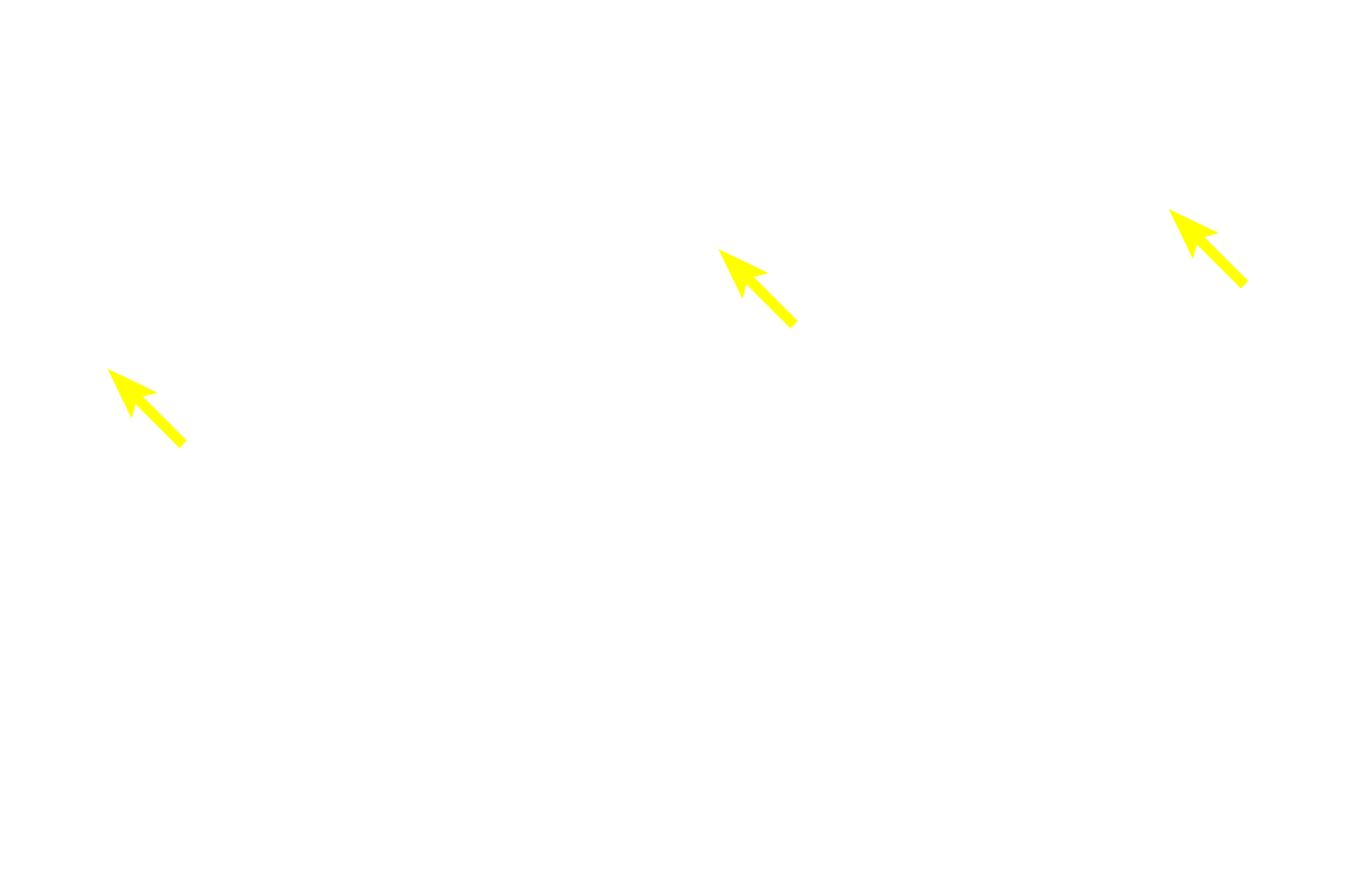 Lamina propria <p>Beneath the lamina propria, elastic fibers become more numerous forming a distinct elastic lamina, separating the lamina propria and submucosa. The elastic lamina provides structural support to maintain patency and also allows for expansion and passive recoil during the inhalation-exhalation cycle. 200x</p>
