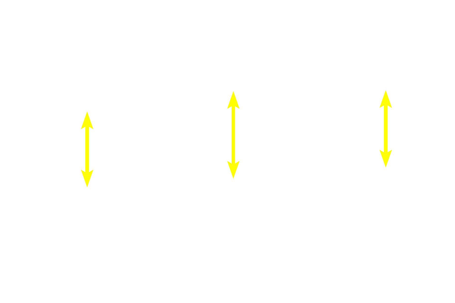 Elastic lamina <p>Beneath the lamina propria, elastic fibers become more numerous forming a distinct elastic lamina, separating the lamina propria and submucosa. The elastic lamina provides structural support to maintain patency and also allows for expansion and passive recoil during the inhalation-exhalation cycle. 200x</p>

