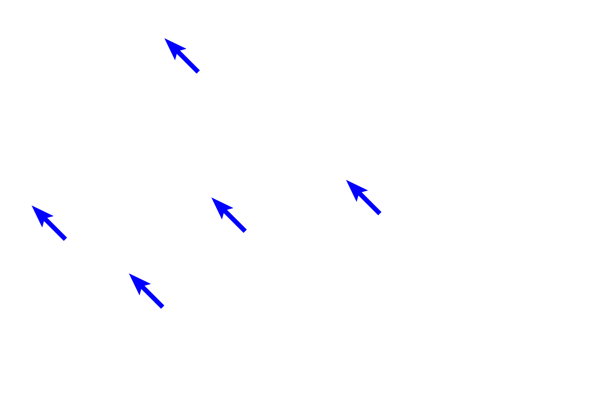  - Cartilage plates <p>Upon entering the lung at the hilum, primary bronchi branch to form secondary (lobar) bronchi, two to the left lung and three to the right lung. Cartilage rings are replaced by cartilage plates but mixed glands persist. This image shows branches of a secondary bronchus, called tertiary or segmental bronchi, also with cartilage plates and mixed glands in their wall. Large pulmonary arteries and veins lie adjacent to these passageways. Millions of alveoli comprise the lung proper, so all intrapulmonary structures, like these bronchi, are surrounded by alveoli. The primary bronchus along with the pulmonary and bronchial vessels form the root of the lung. 10x</p>
