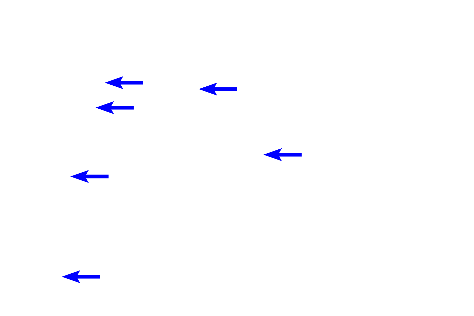  - Mixed glands <p>Upon entering the lung at the hilum, primary bronchi branch to form secondary (lobar) bronchi, two to the left lung and three to the right lung. Cartilage rings are replaced by cartilage plates but mixed glands persist. This image shows branches of a secondary bronchus, called tertiary or segmental bronchi, also with cartilage plates and mixed glands in their wall. Large pulmonary arteries and veins lie adjacent to these passageways. Millions of alveoli comprise the lung proper, so all intrapulmonary structures, like these bronchi, are surrounded by alveoli. The primary bronchus along with the pulmonary and bronchial vessels form the root of the lung. 10x</p>
