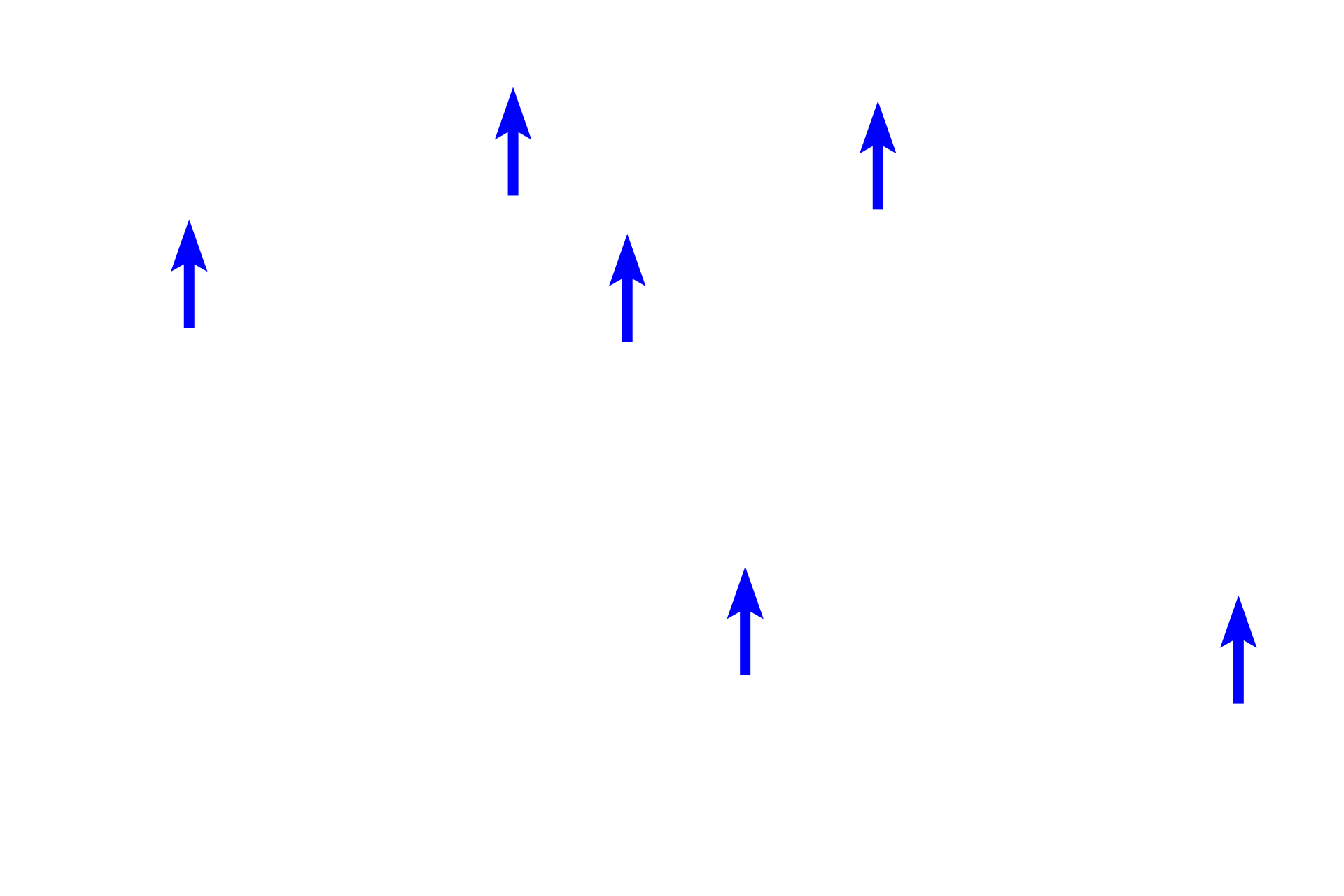 Pulmonary vessels <p>Upon entering the lung at the hilum, primary bronchi branch to form secondary (lobar) bronchi, two to the left lung and three to the right lung. Cartilage rings are replaced by cartilage plates but mixed glands persist. This image shows branches of a secondary bronchus, called tertiary or segmental bronchi, also with cartilage plates and mixed glands in their wall. Large pulmonary arteries and veins lie adjacent to these passageways. Millions of alveoli comprise the lung proper, so all intrapulmonary structures, like these bronchi, are surrounded by alveoli. The primary bronchus along with the pulmonary and bronchial vessels form the root of the lung. 10x</p>
