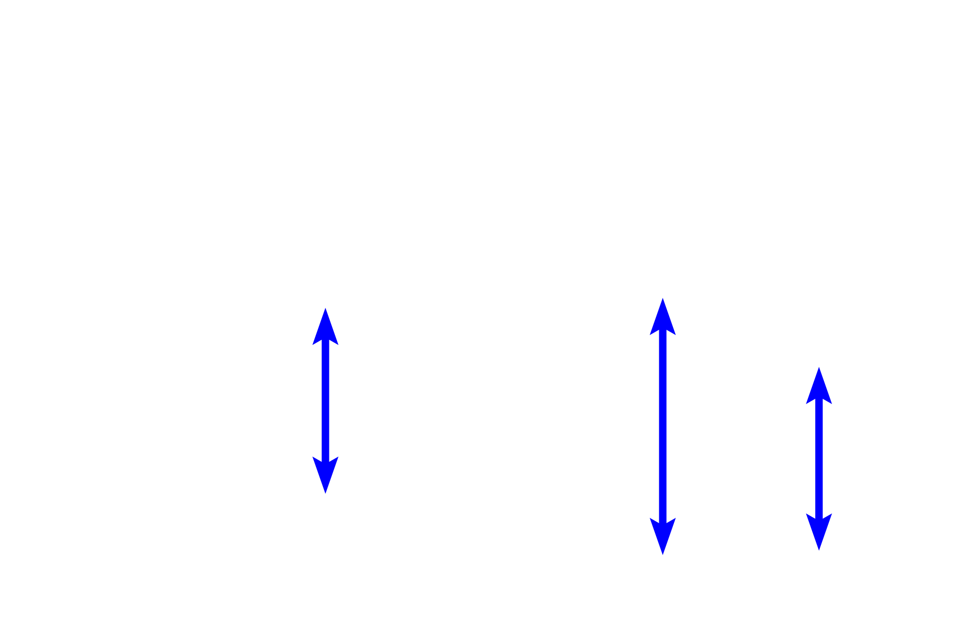 Bronchi <p>Bronchi are intrapulmonary passages that are part of the conducting portion of the respiratory system. As bronchi branches from the primary bronchus, they become smaller in diameter and their wall thins. Cartilage plates and mixed glands remain, distinguishing these passages from bronchioles.  100x</p>
