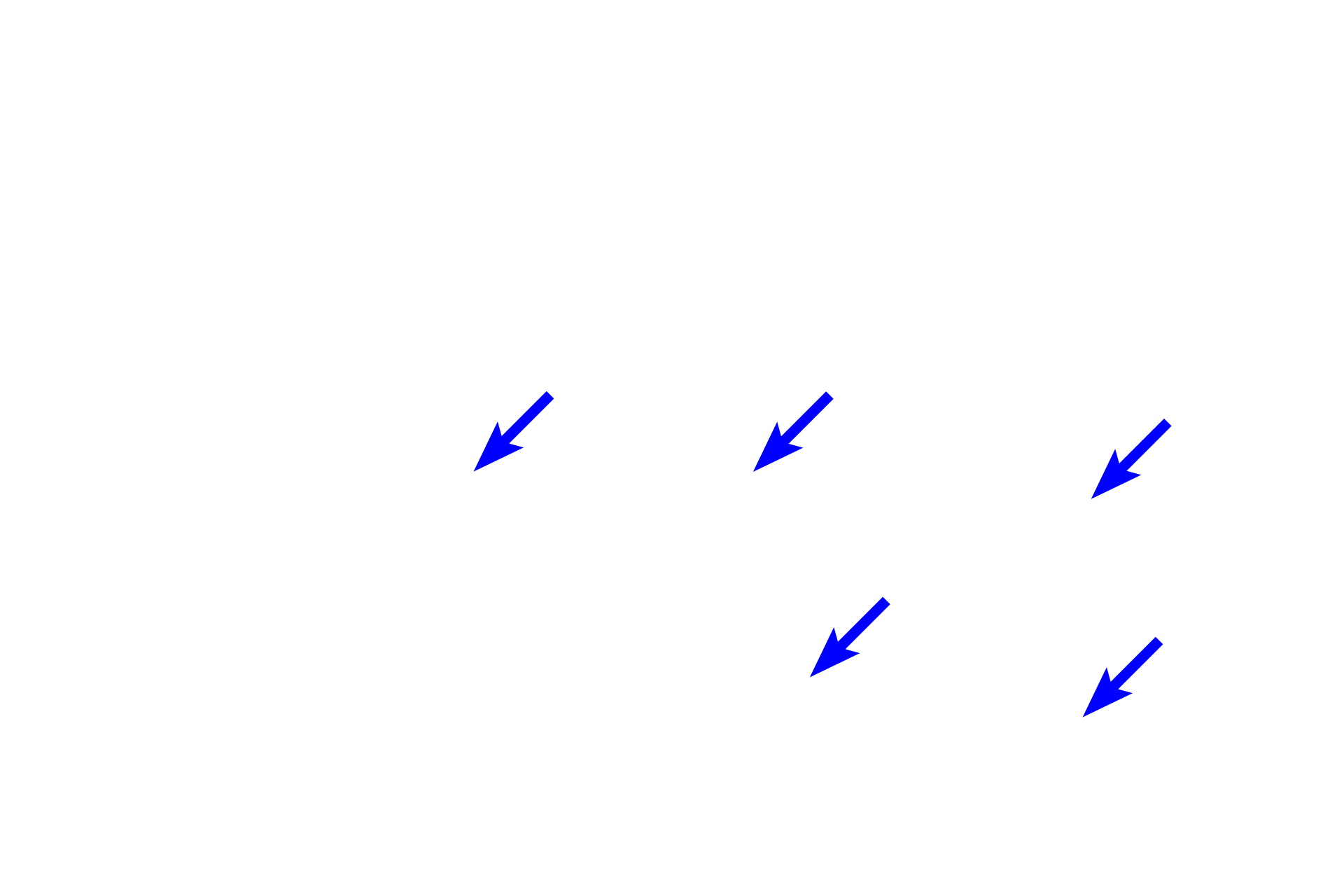  - Cartilage plates <p>Bronchi are intrapulmonary passages that are part of the conducting portion of the respiratory system. As bronchi branches from the primary bronchus, they become smaller in diameter and their wall thins. Cartilage plates and mixed glands remain, distinguishing these passages from bronchioles.  100x</p>
