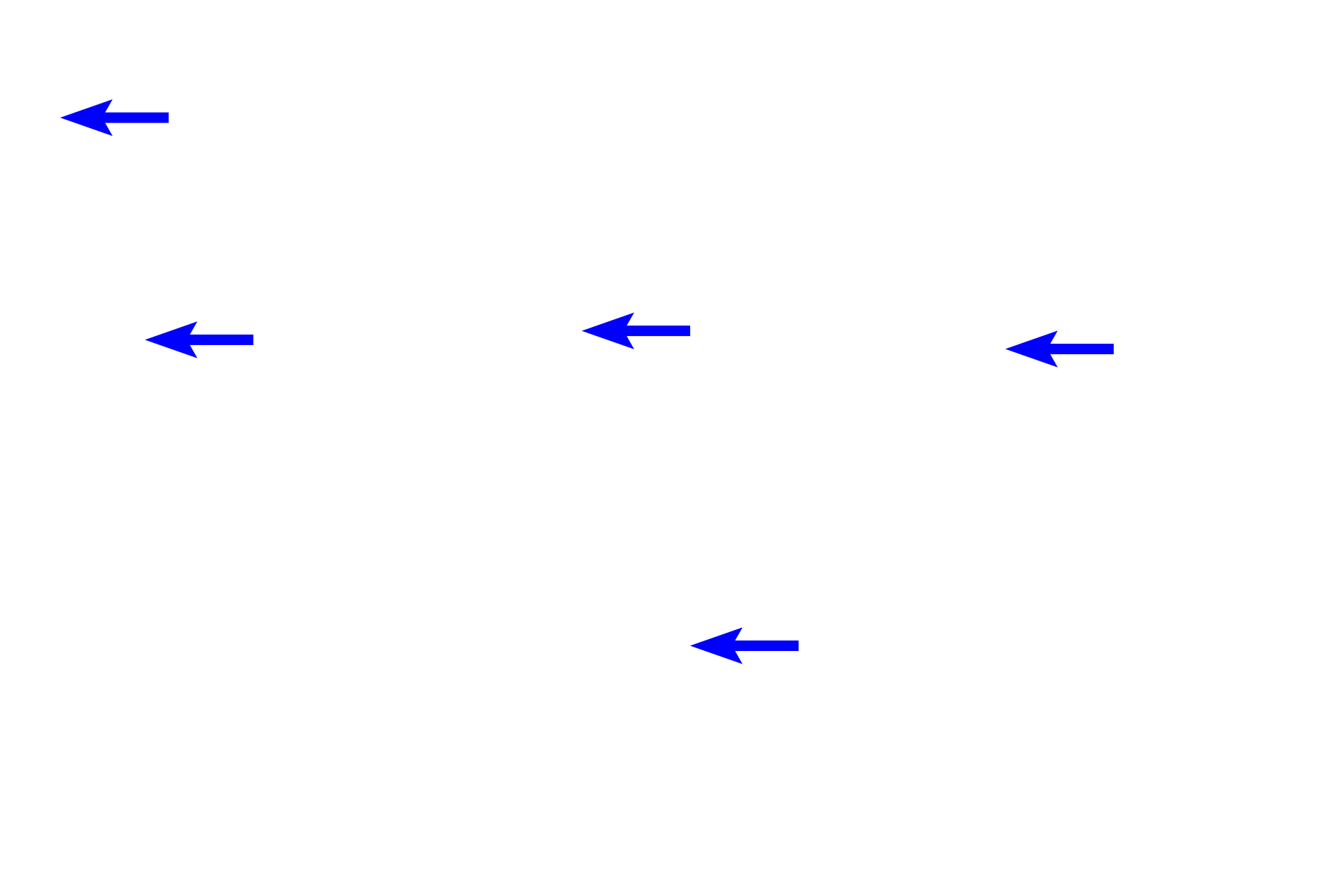 Pulmonary vessels > <p>These vessels are pulmonary arteries which lie adjacent to the respiratory passageways and travel with them down to level of the alveoli. Unlike most arteries, pulmonary arteries carry deoxygenated blood.   </p>
