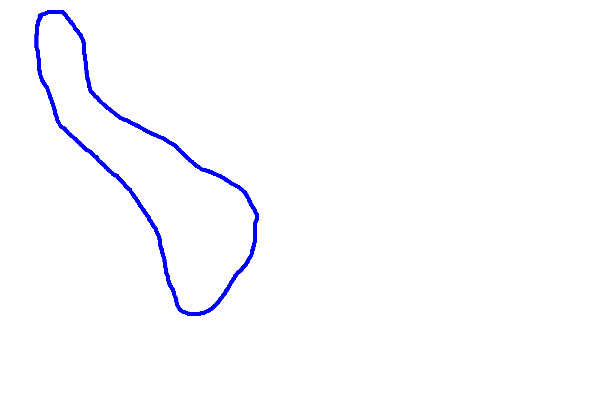 Transition >  <p>The outlined area shows a respiratory passageway that is transitioning from a bronchus (bottom) to a bronchiole (top). The tissue between is a tangential section through the wall of the passageway showing mixed glands. Note the lack of cartilage in the wall of the bronchiole.</p>
