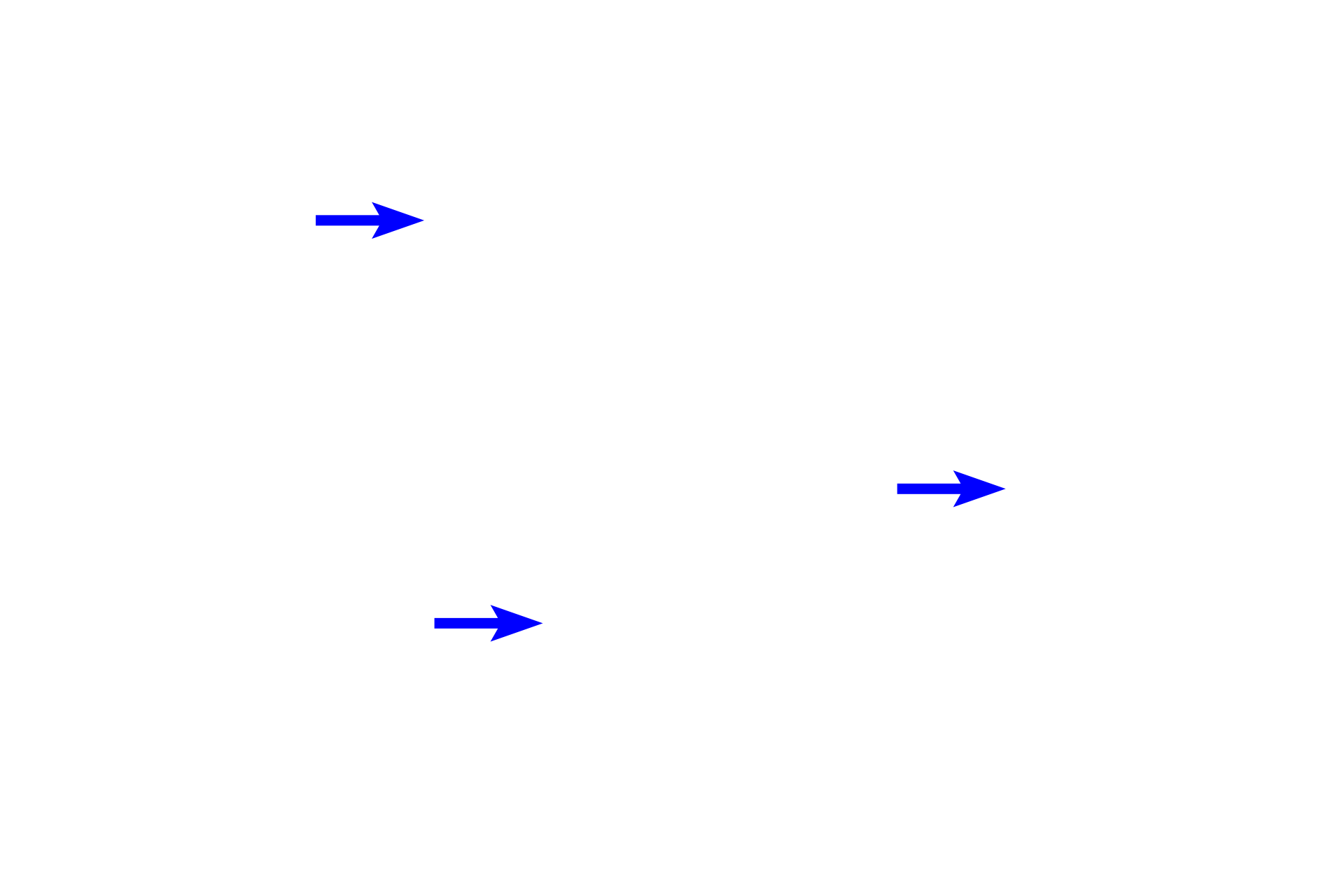 Lamina propria <p>As bronchi decrease in size, each layer becomes thinner and the size of the cartilage plates is reduced.  400x</p>
