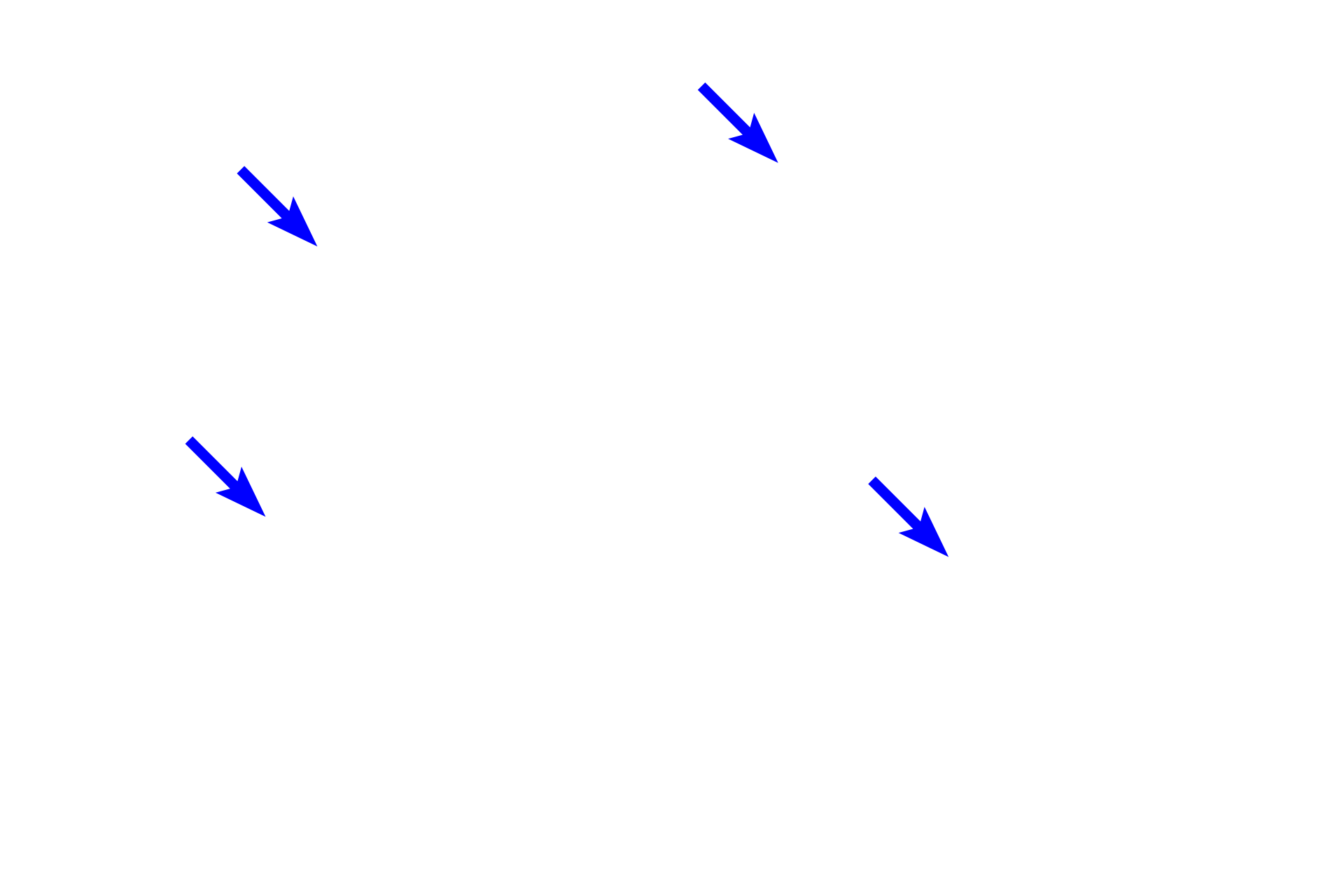  - Smooth muscle <p>As bronchi decrease in size, each layer becomes thinner and the size of the cartilage plates is reduced.  400x</p>
