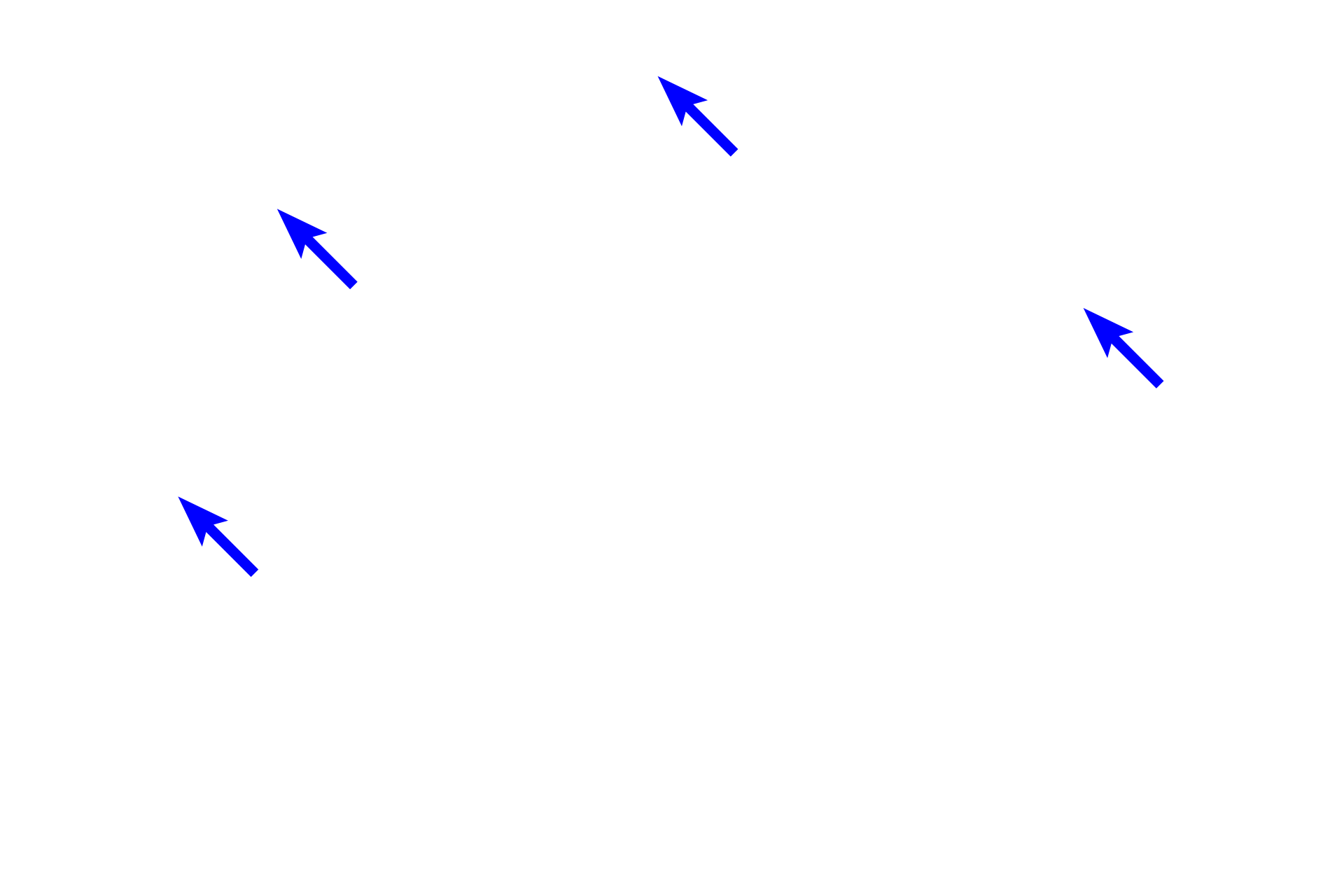  - Mixed glands <p>As bronchi decrease in size, each layer becomes thinner and the size of the cartilage plates is reduced.  400x</p>
