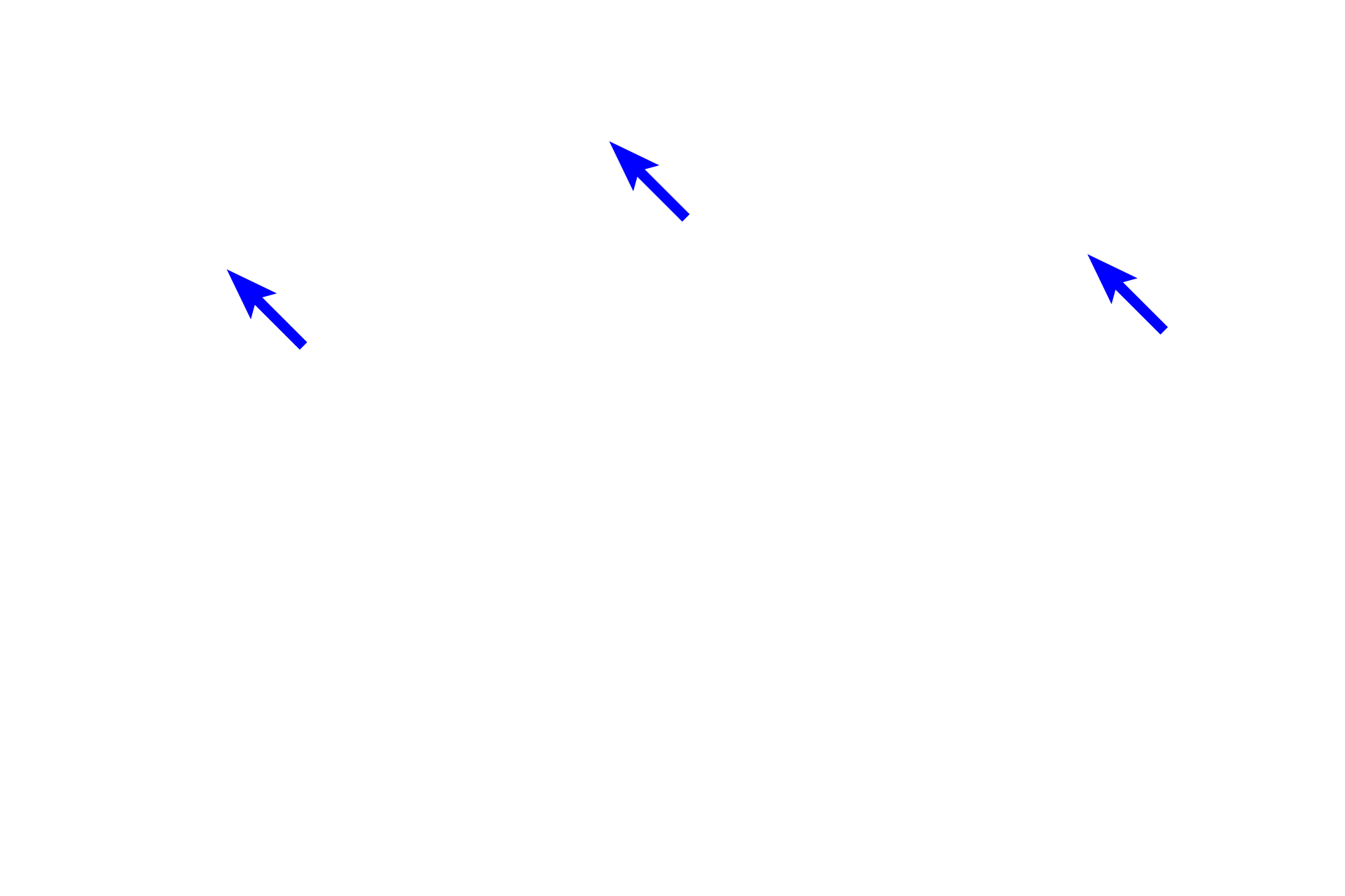 Bronchial blood vessels <p>As bronchi decrease in size, each layer becomes thinner and the size of the cartilage plates is reduced.  400x</p>

