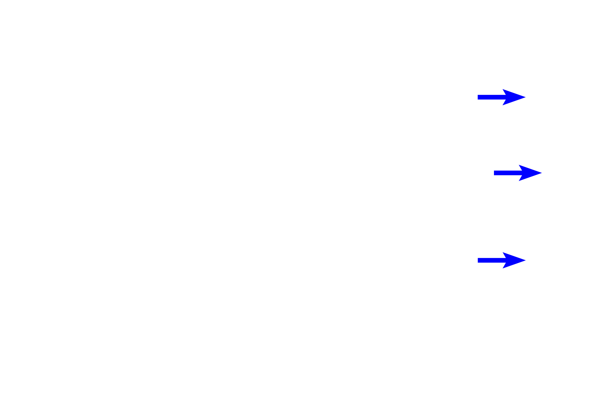 Alveoli <p>As bronchi decrease in size, each layer becomes thinner and the size of the cartilage plates is reduced.  400x</p>
