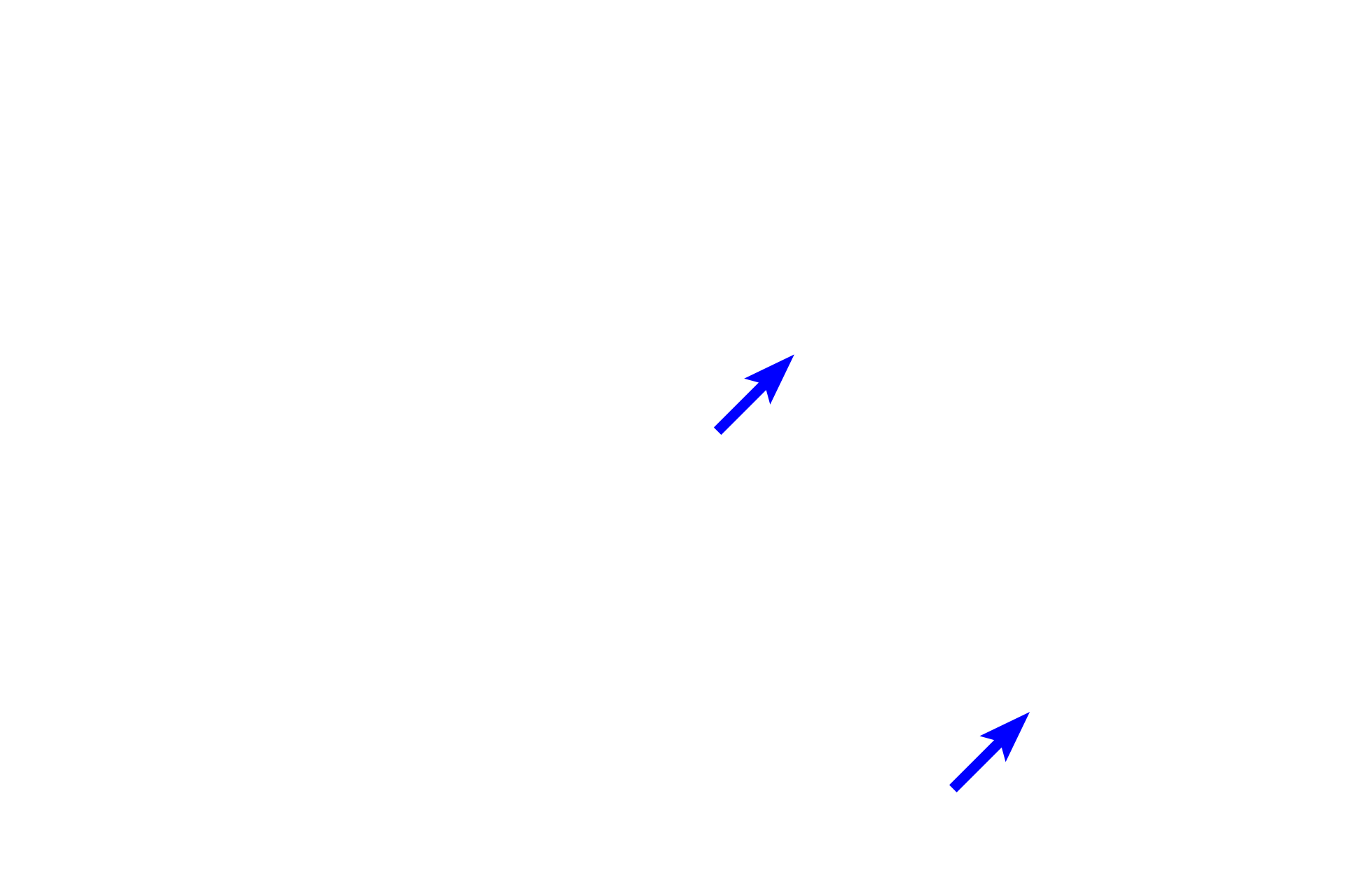 Cartilage plates <p>This longitudinal section shows a respiratory passageway transitioning from a bronchus (right of the line) to a bronchiole (left). Both are lined by a pseudostratified columnar epithelium with cilia and goblet cells, and their mucosae contain smooth muscle. Cartilage and glands are not present in bronchioles, features that serve to readily distinguish these passageways. 100x</p>
