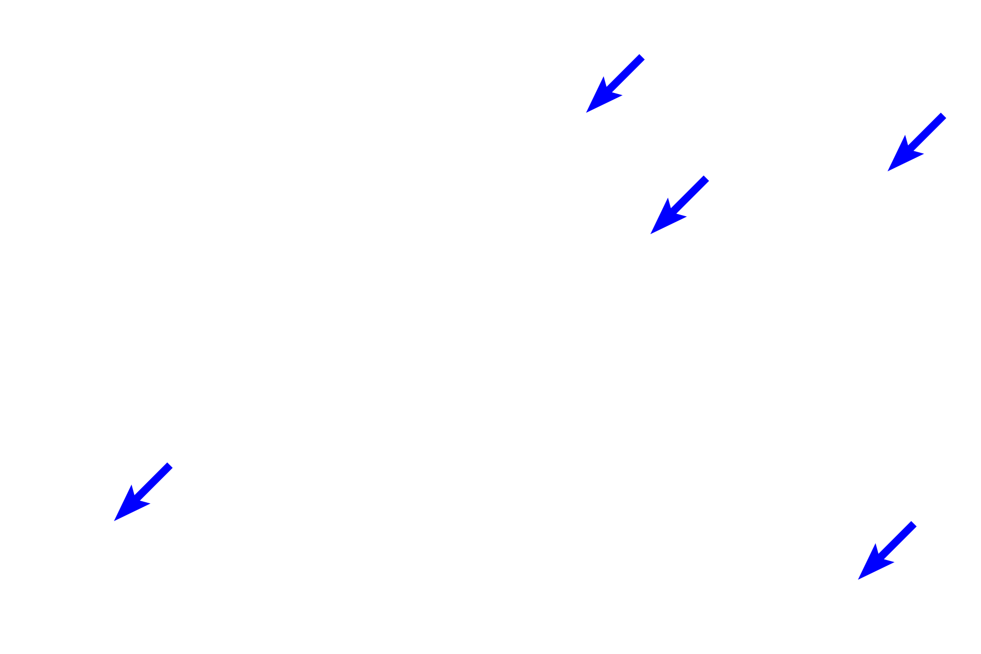 Alveoli <p>This longitudinal section shows a respiratory passageway transitioning from a bronchus (right of the line) to a bronchiole (left). Both are lined by a pseudostratified columnar epithelium with cilia and goblet cells, and their mucosae contain smooth muscle. Cartilage and glands are not present in bronchioles, features that serve to readily distinguish these passageways. 100x</p>

