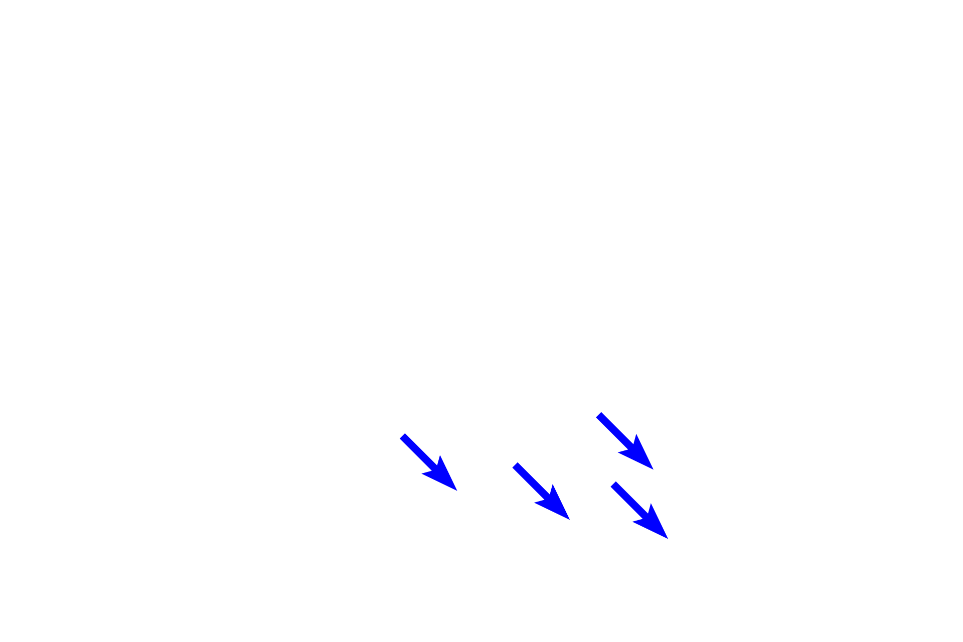 Macrophages > <p>The black carbon particles are located in macrophages that have phagocytosed inhaled particulate matter. These cells, often referred to as dust cells, migrate into alveolar spaces where they remove debris and then accumulate in the surrounding connective tissue.</p>

