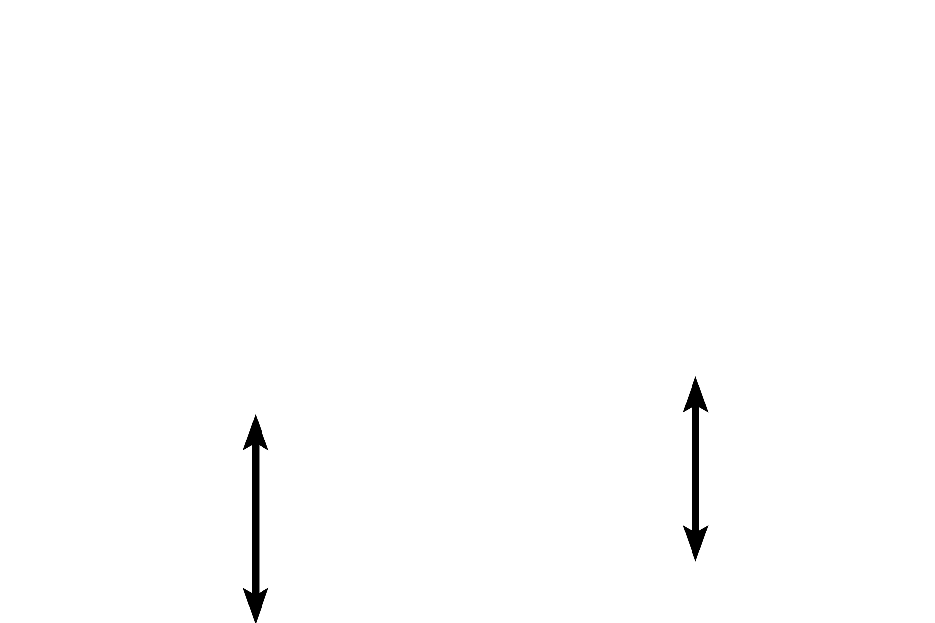 Supporting layer > <p>Cartilage or bone supports the walls of the larger passageways, keeping the lumen open (patent). This supporting layer diminishes and eventually disappears as passageways become smaller in diameter. </p>
