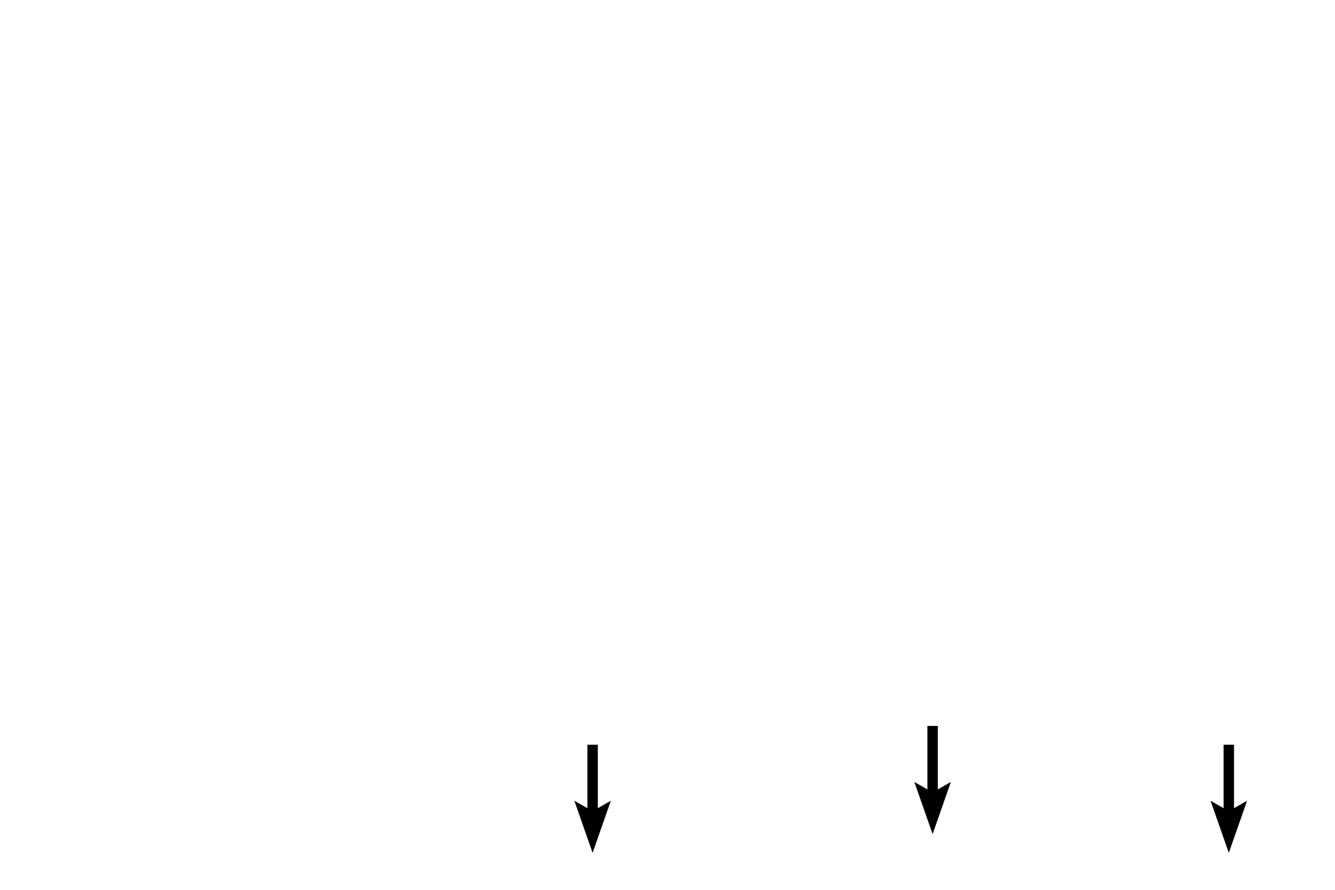 Connective tissue > <p>Another layer of loose connective tissue surrounds the outer surface of the cartilage. </p>
