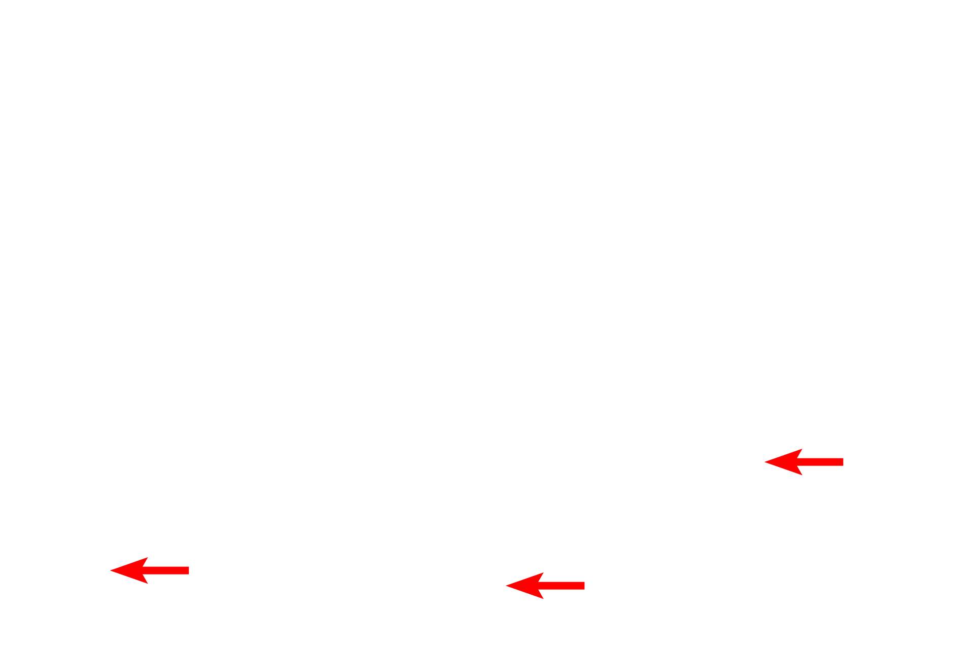 Basement membrane <p>The epithelium that lines much of the respiratory system is pseudostratified columnar with cilia and goblet cells. The basement membrane is often very prominent. 1000x</p>
