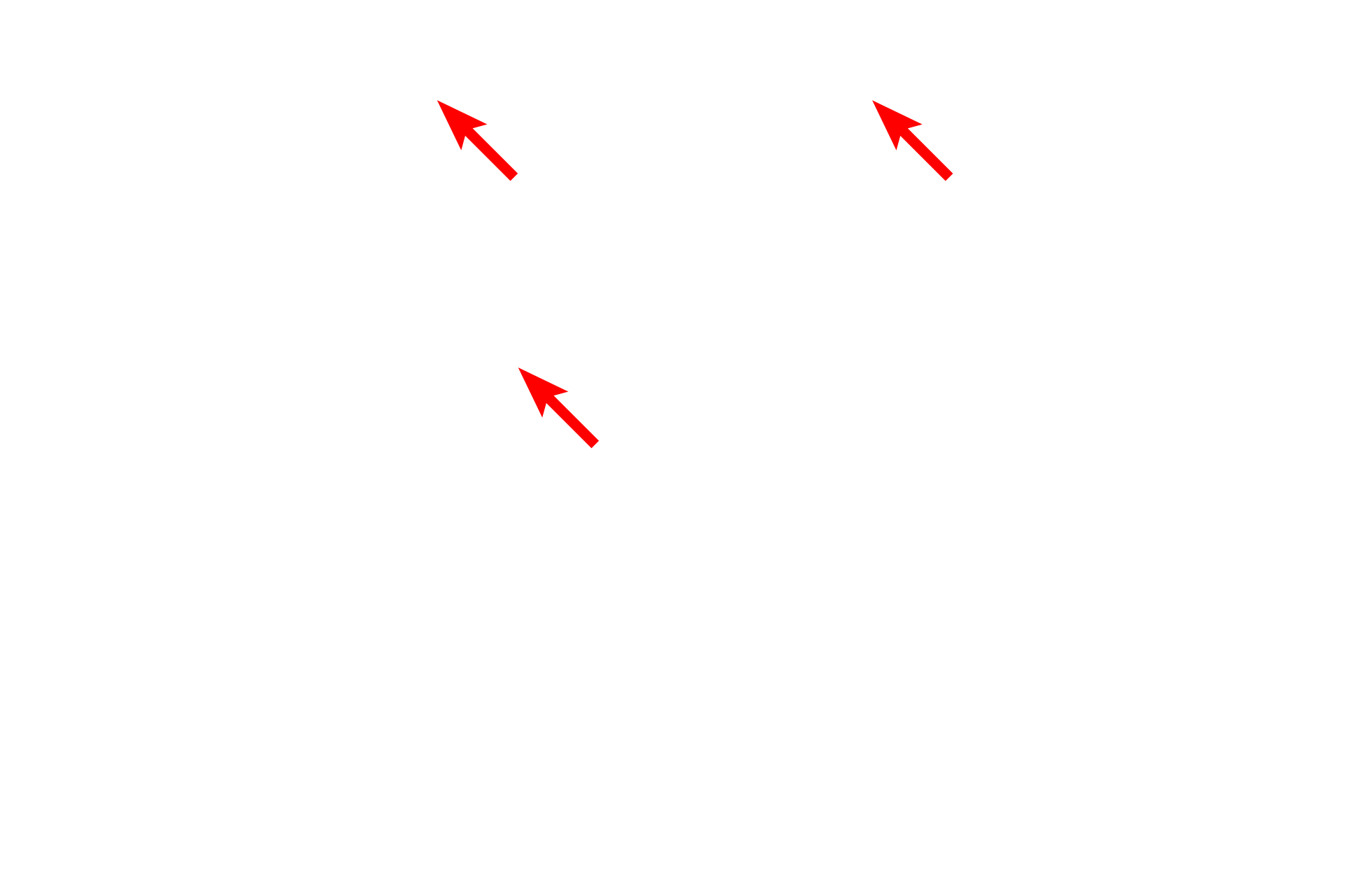  - Cilia <p>The epithelium that lines much of the respiratory system is pseudostratified columnar with cilia and goblet cells. The basement membrane is often very prominent. 1000x</p>
