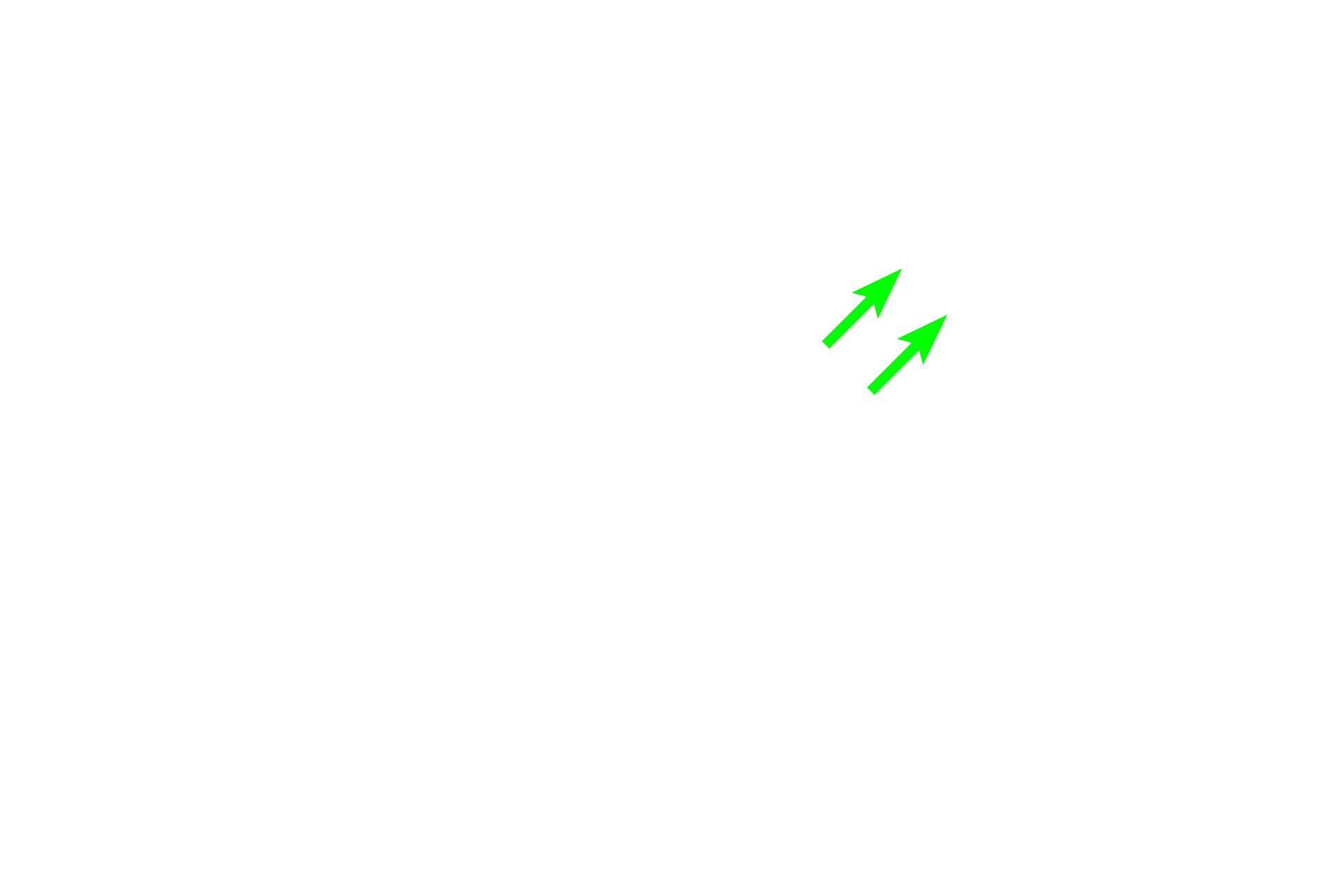 Bronchial vein <p>Two arterial systems, bronchial and pulmonary, supply blood to lung tissue. This image show a bronchial artery and vein in the wall of large bronchus. Bronchial arteries supply oxygenated blood to the tissues forming the walls of respiratory passageways. They originate as branches of the descending thoracic aorta and travel within the wall of the passageways. Pulmonary arteries, carrying deoxygenated blood, travel adjacent to respiratory passageways and supply alveolar capillaries where gas exchange occurs.  250x</p>
