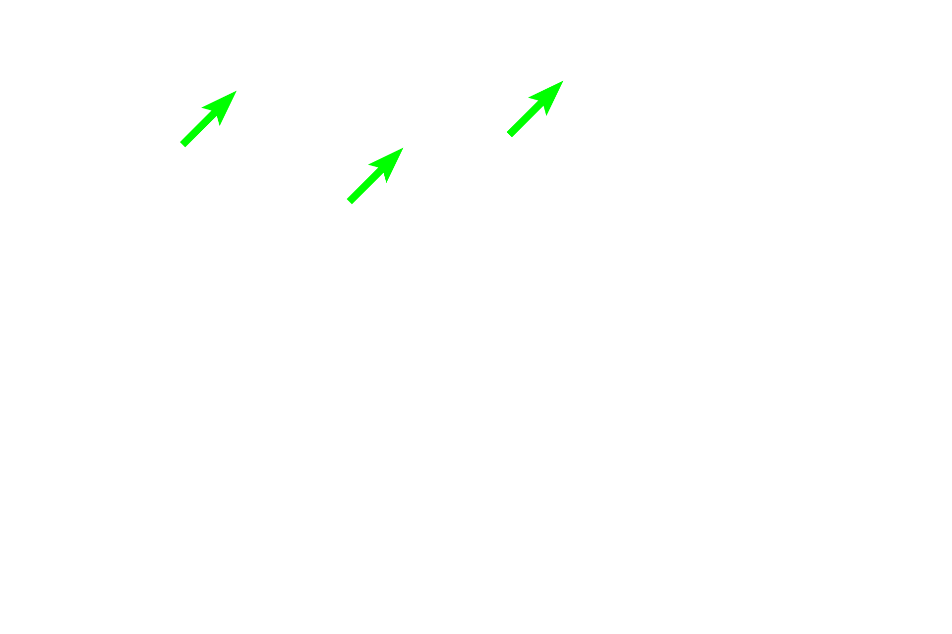  - Lamina propria <p>Two arterial systems, bronchial and pulmonary, supply blood to lung tissue. This image show a bronchial artery and vein in the wall of large bronchus. Bronchial arteries supply oxygenated blood to the tissues forming the walls of respiratory passageways. They originate as branches of the descending thoracic aorta and travel within the wall of the passageways. Pulmonary arteries, carrying deoxygenated blood, travel adjacent to respiratory passageways and supply alveolar capillaries where gas exchange occurs.  250x</p>
