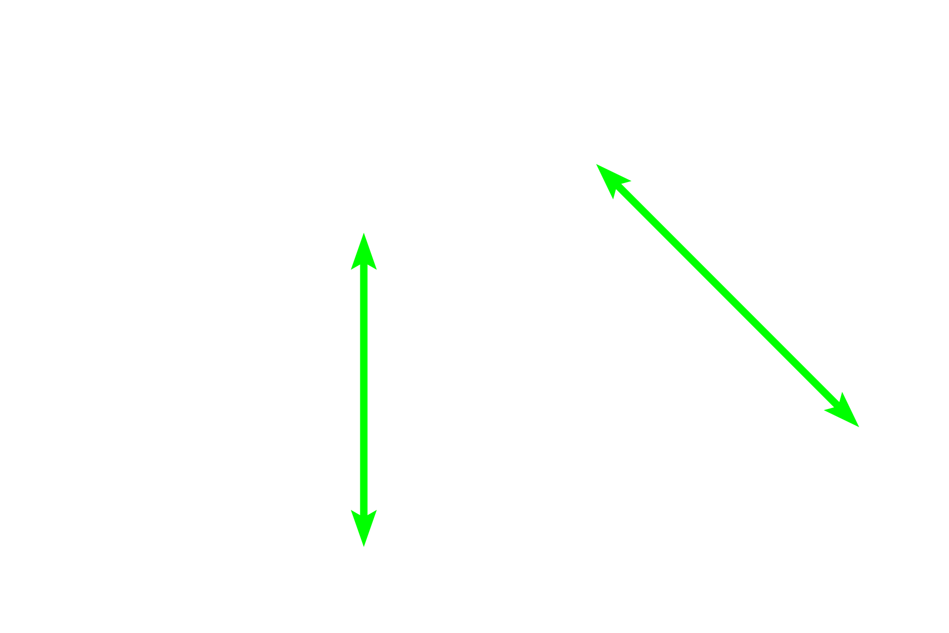 Submucosa <p>Two arterial systems, bronchial and pulmonary, supply blood to lung tissue. This image show a bronchial artery and vein in the wall of large bronchus. Bronchial arteries supply oxygenated blood to the tissues forming the walls of respiratory passageways. They originate as branches of the descending thoracic aorta and travel within the wall of the passageways. Pulmonary arteries, carrying deoxygenated blood, travel adjacent to respiratory passageways and supply alveolar capillaries where gas exchange occurs.  250x</p>
