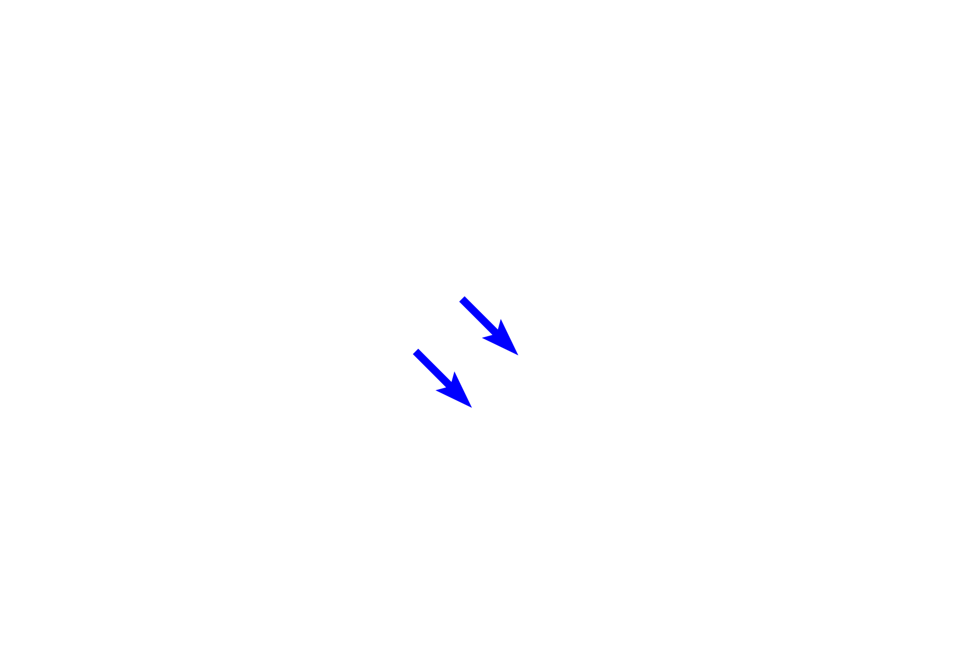 Bronchial vein <p>A bronchial vein is seen in the submucosa of a smaller bronchus. Like other systemic veins, bronchial veins carry deoxygenated blood. The majority of bronchial blood drains into pulmonary veins; the remainder enters the systemic venous system.  200x  </p>

