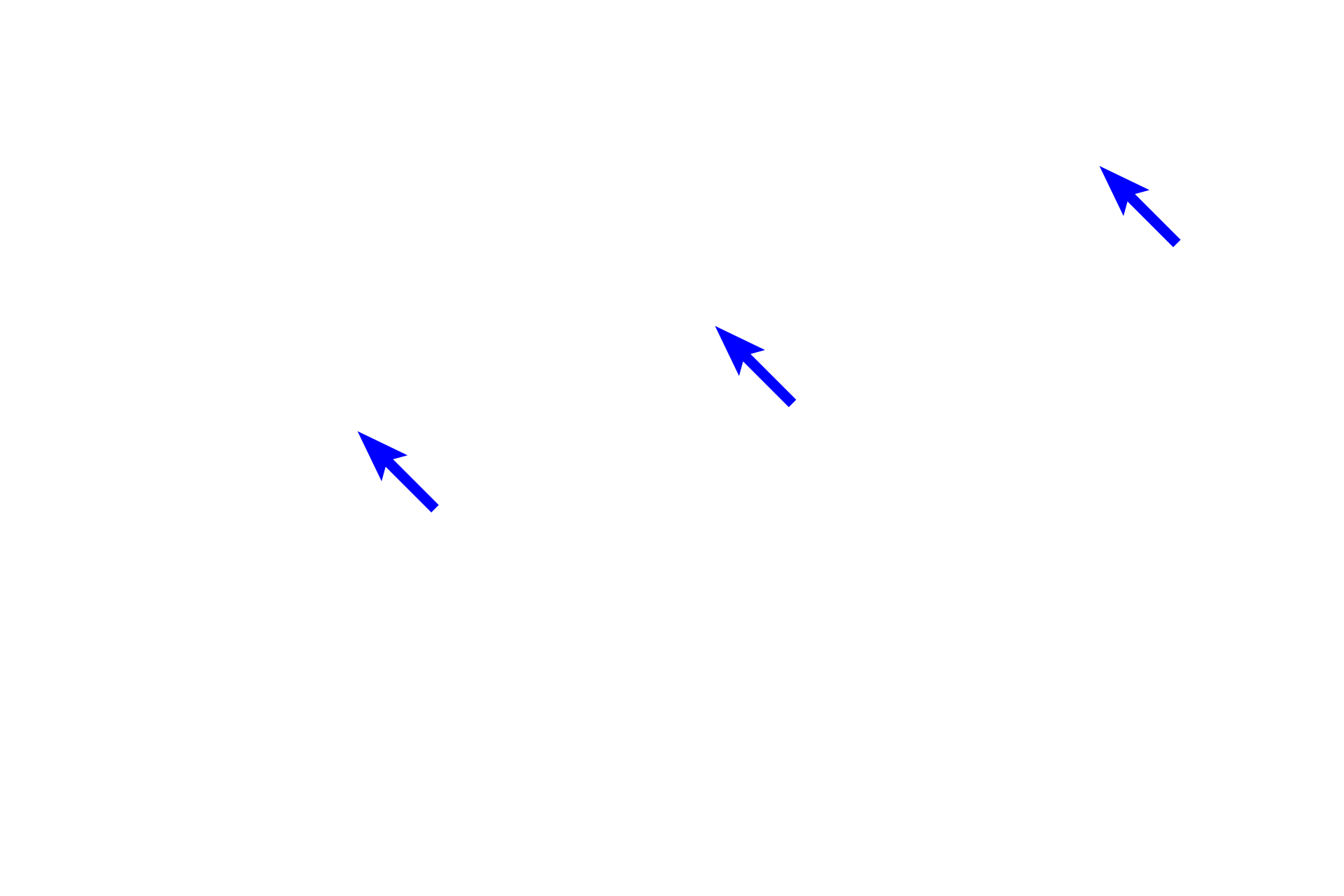 - Elastic lamina <p>A bronchial vein is seen in the submucosa of a smaller bronchus. Like other systemic veins, bronchial veins carry deoxygenated blood. The majority of bronchial blood drains into pulmonary veins; the remainder enters the systemic venous system.  200x  </p>
