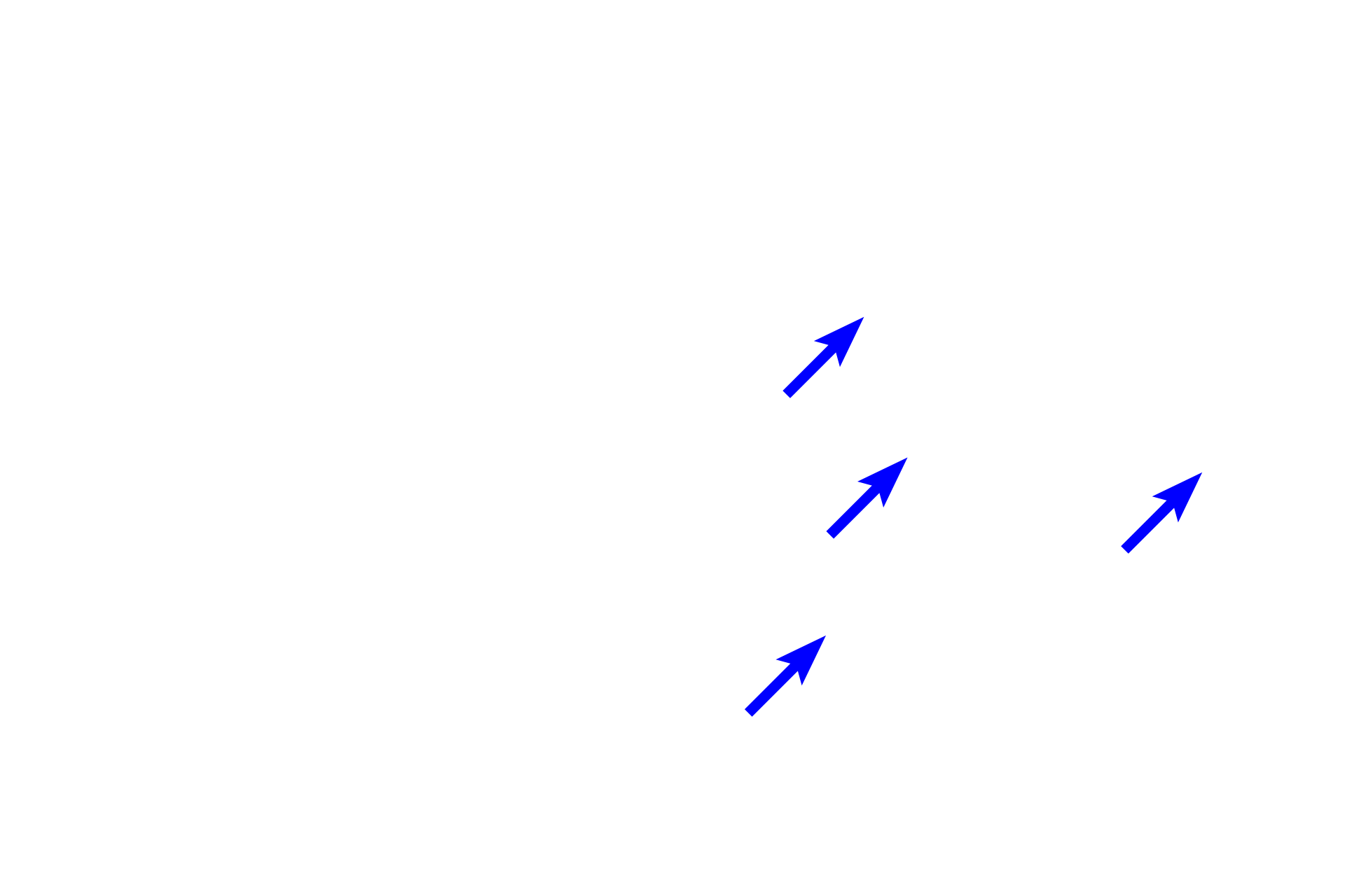 Mixed glands <p>A bronchial vein is seen in the submucosa of a smaller bronchus. Like other systemic veins, bronchial veins carry deoxygenated blood. The majority of bronchial blood drains into pulmonary veins; the remainder enters the systemic venous system.  200x  </p>
