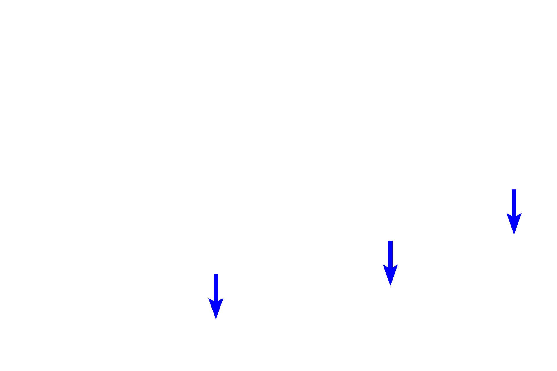 Perichondrium <p>A bronchial vein is seen in the submucosa of a smaller bronchus. Like other systemic veins, bronchial veins carry deoxygenated blood. The majority of bronchial blood drains into pulmonary veins; the remainder enters the systemic venous system.  200x  </p>
