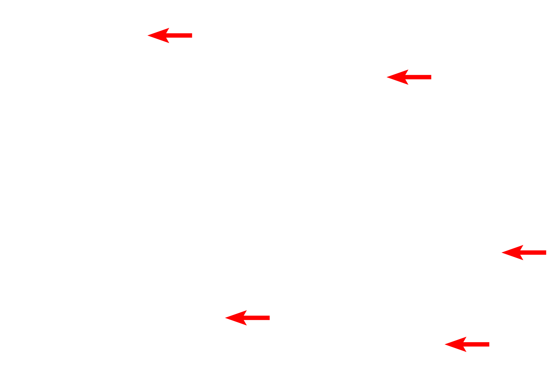 Bronchial vessels <p>Bronchial vessels are shown in the wall of this small bronchus.  200x</p>
