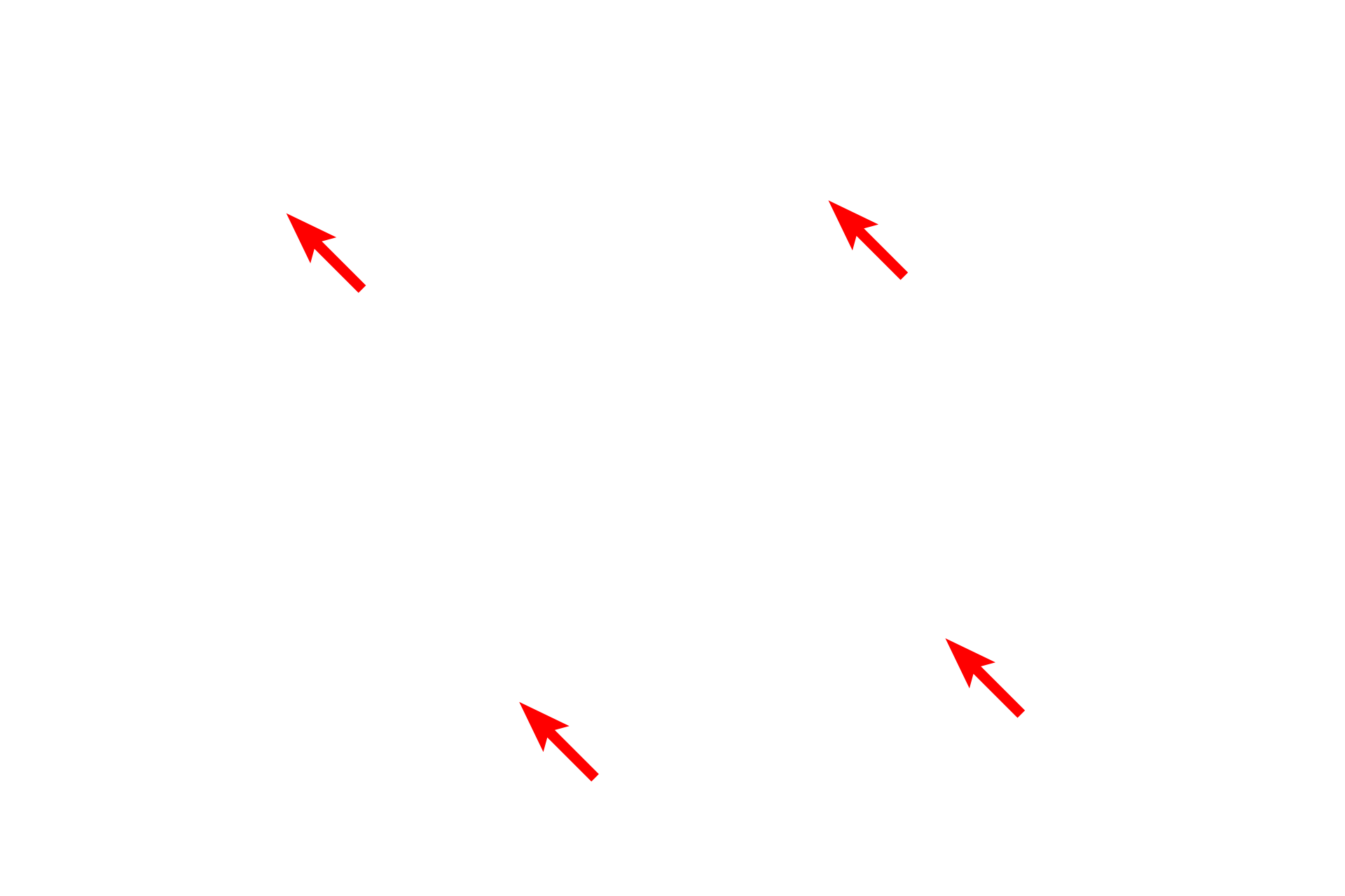 Epithelium <p>Bronchial vessels are shown in the wall of this small bronchus.  200x</p>
