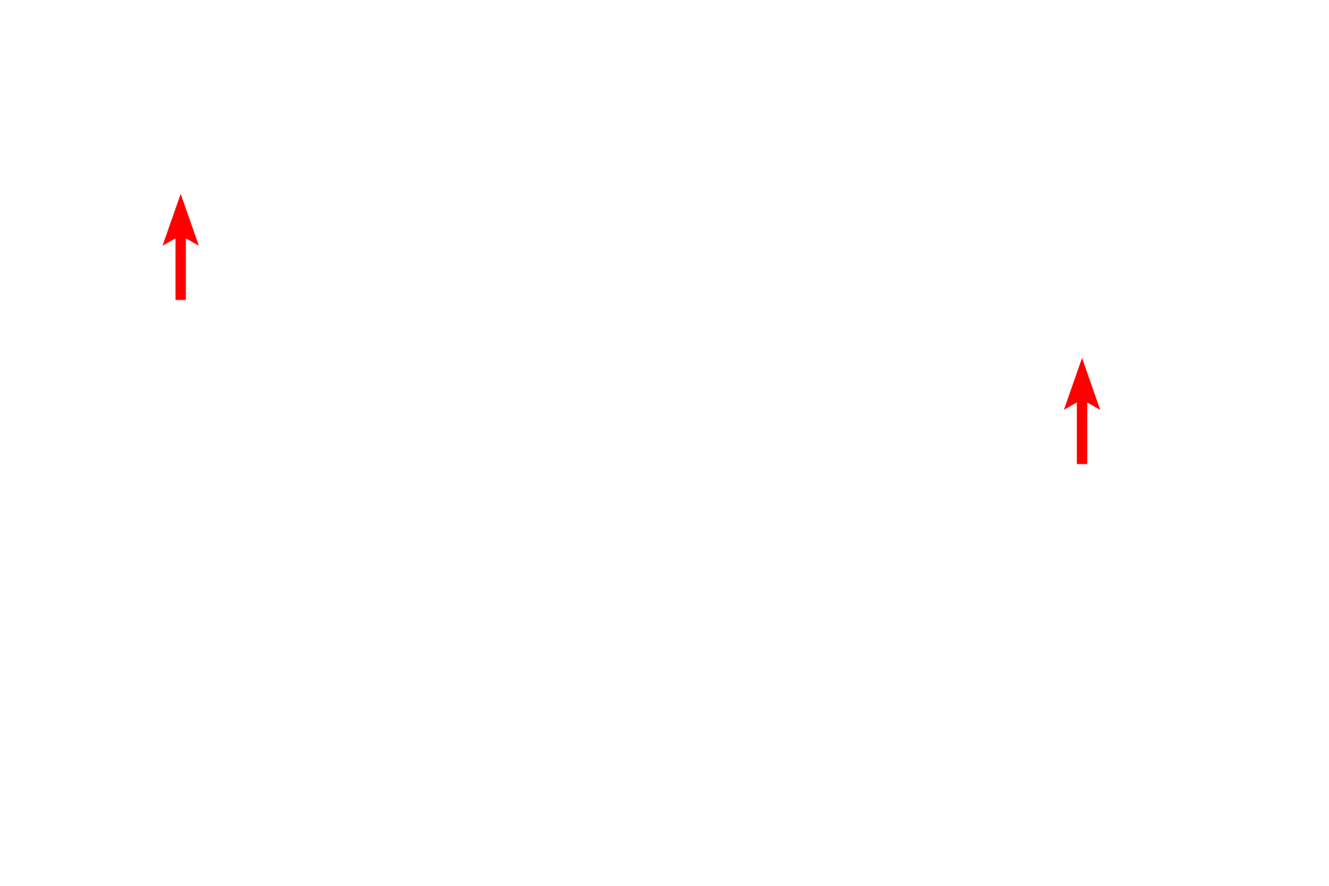 Muscularis <p>Bronchial vessels are shown in the wall of this small bronchus.  200x</p>
