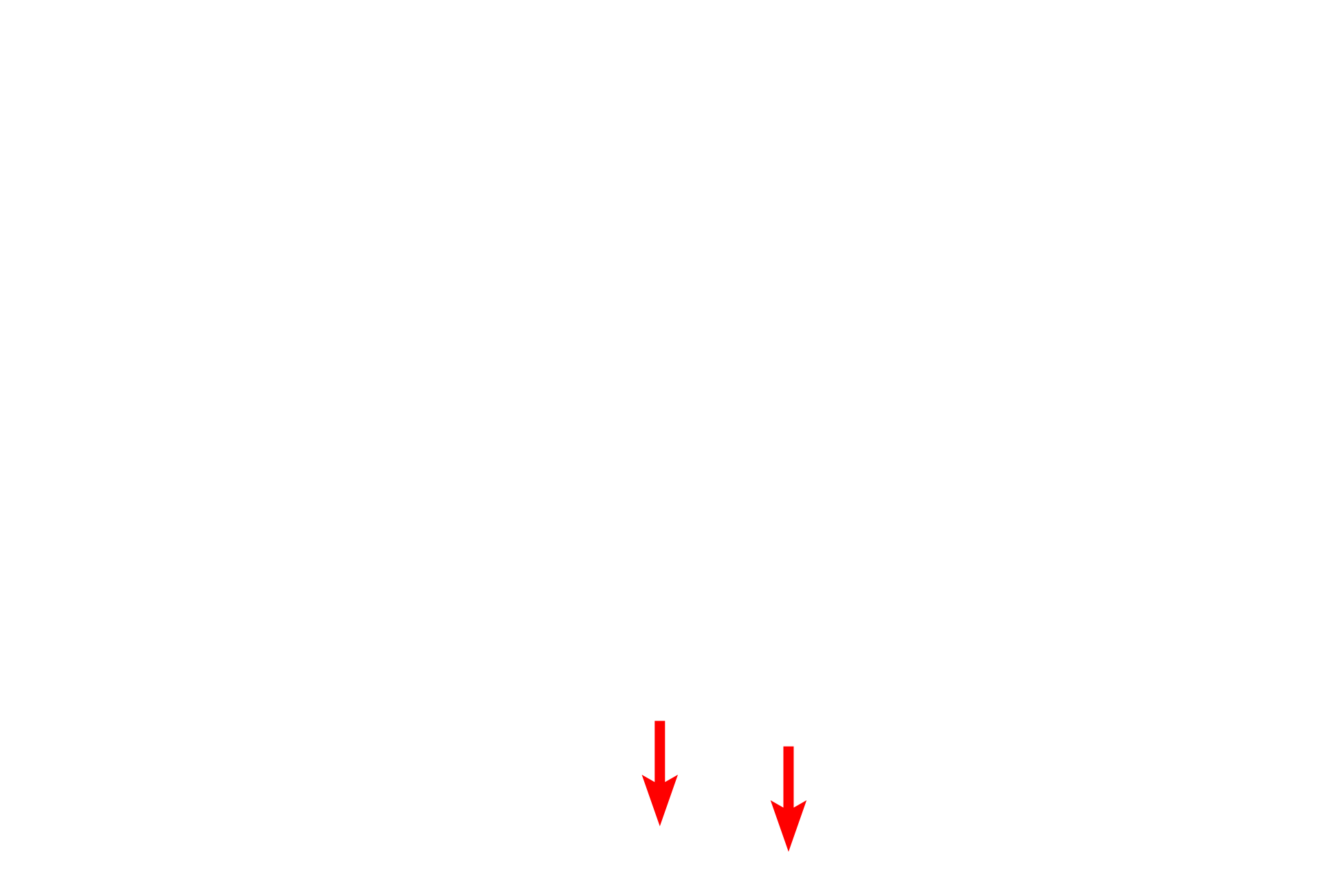Cartilage plate <p>Bronchial vessels are shown in the wall of this small bronchus.  200x</p>

