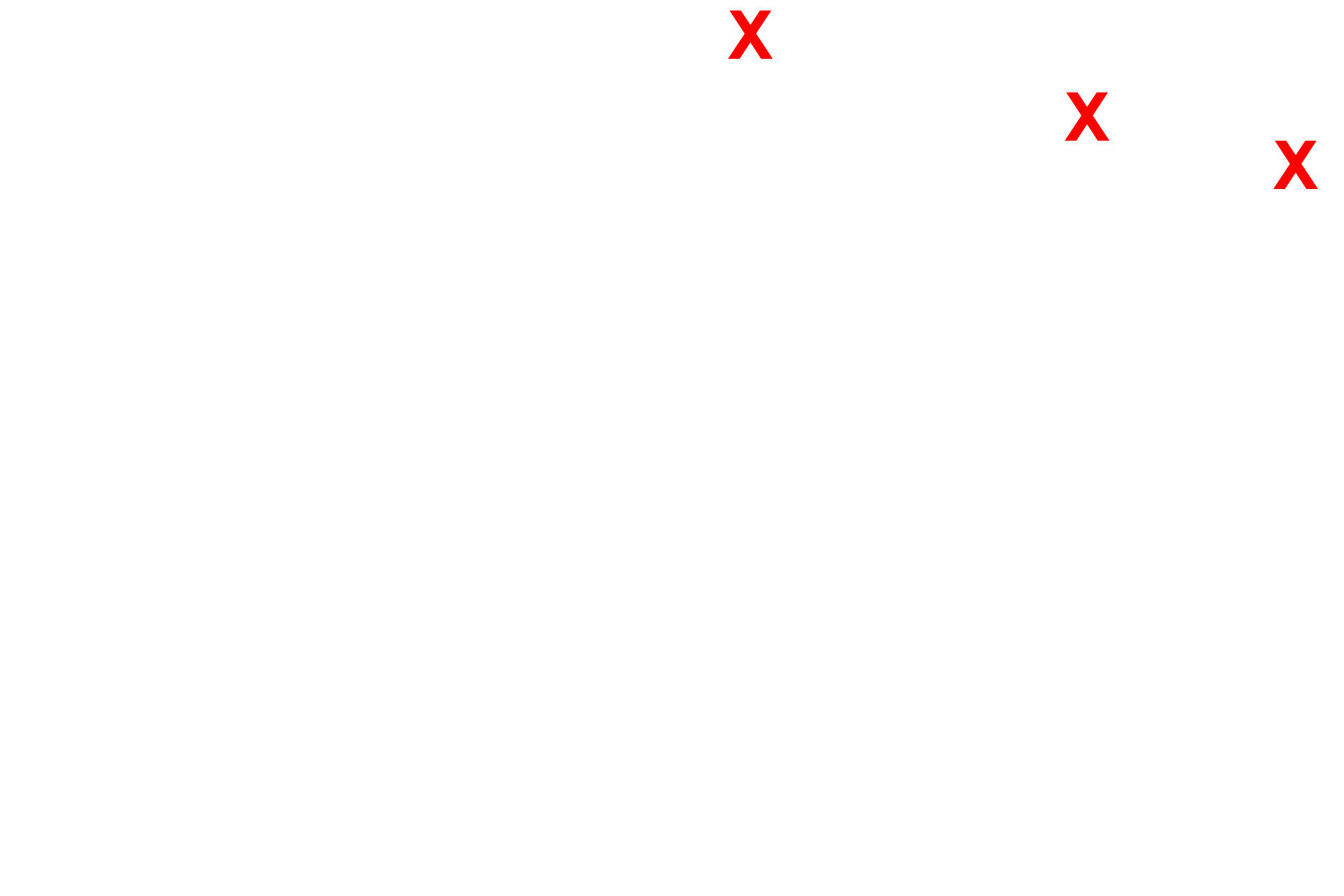 Alveoli <p>Bronchial vessels are shown in the wall of this small bronchus.  200x</p>
