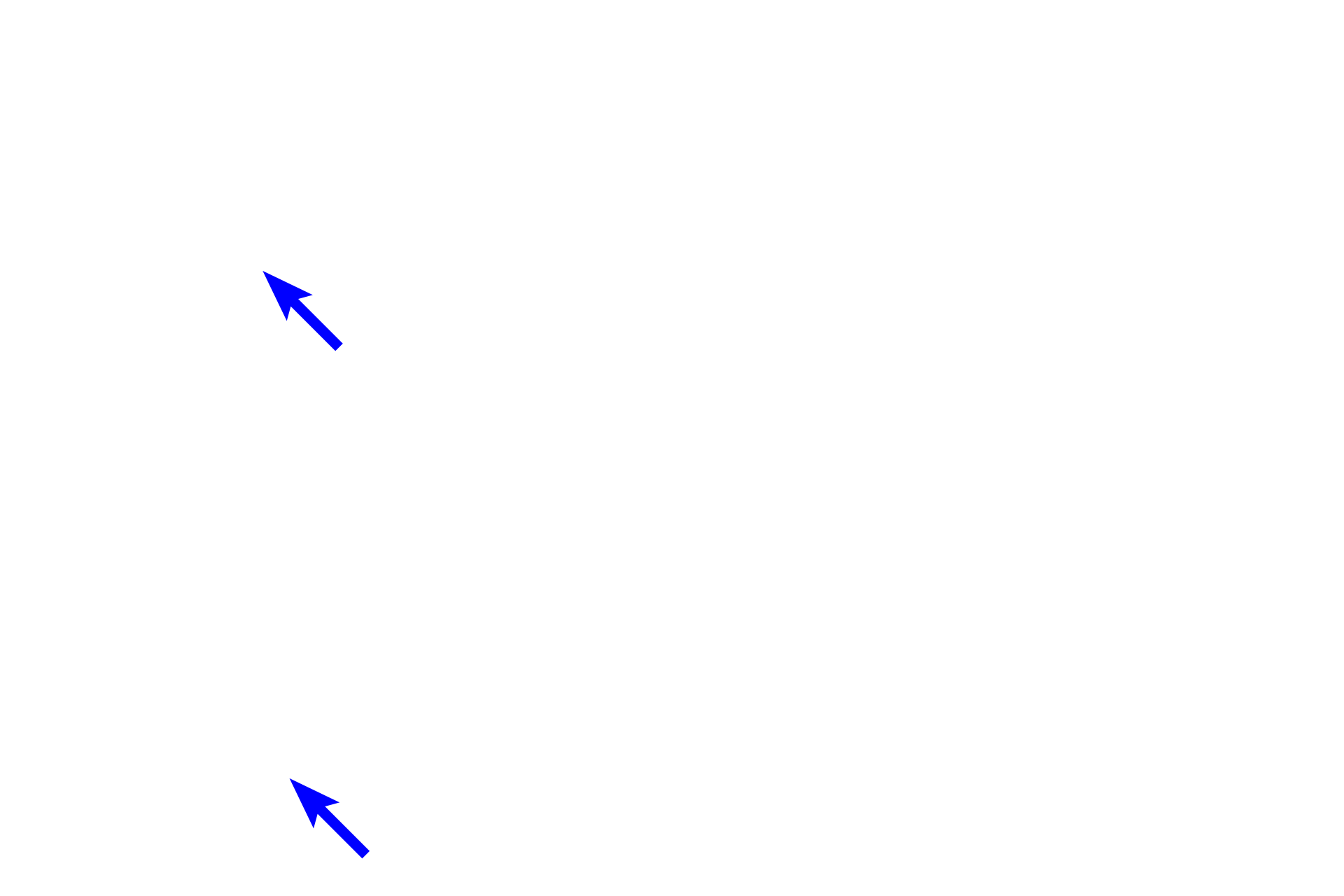 Bronchial veins <p>Bronchial vessels are shown in the walls of these bronchioles. In order to supply tissues that form the wall of respiratory passageways, bronchial vessels must lie within the wall, making their diameter smaller than the thickness of that wall. 200x, 400x</p>

