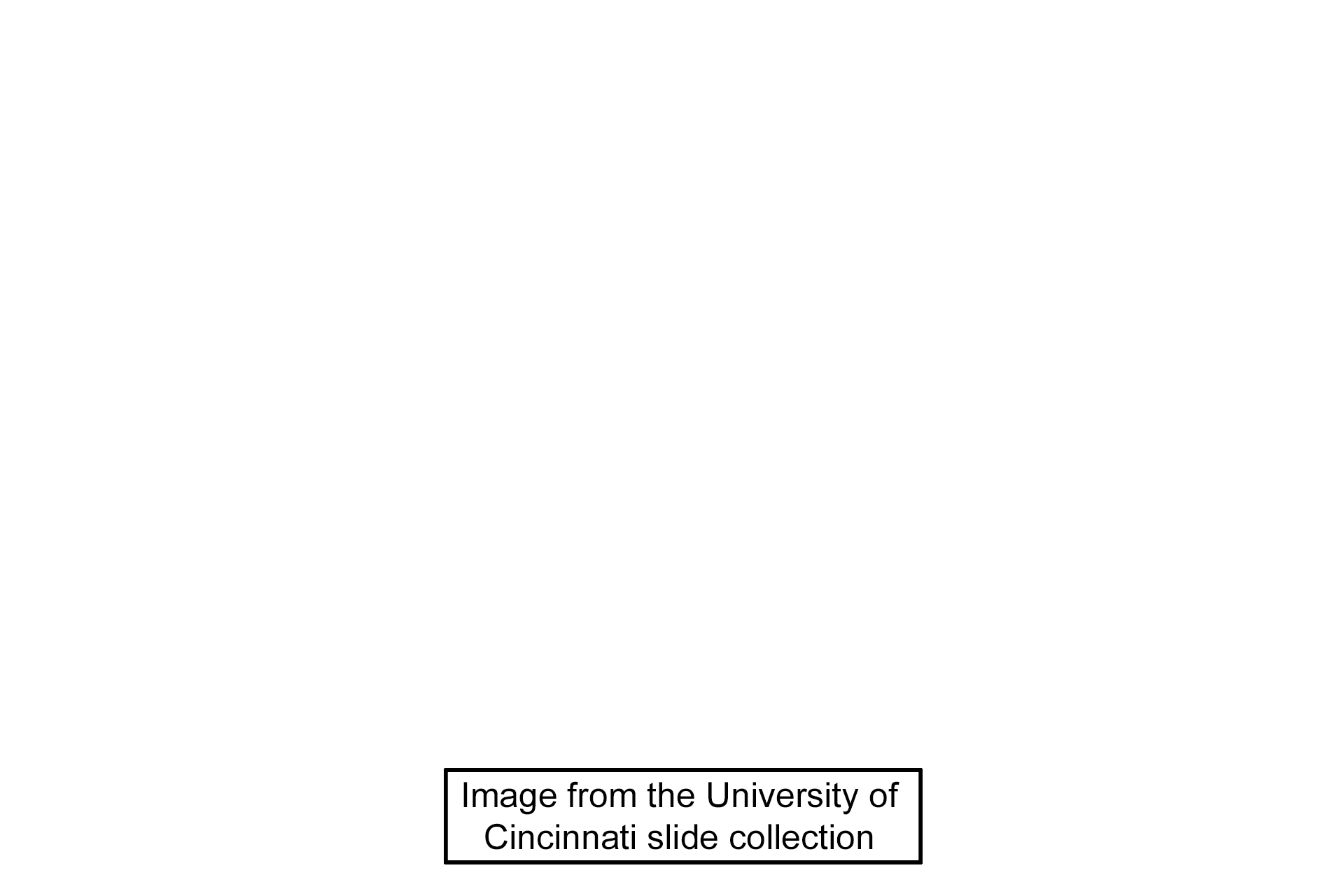 Image source > <p>This image was taken of a slide in the University of Cincinnati collection.</p>
