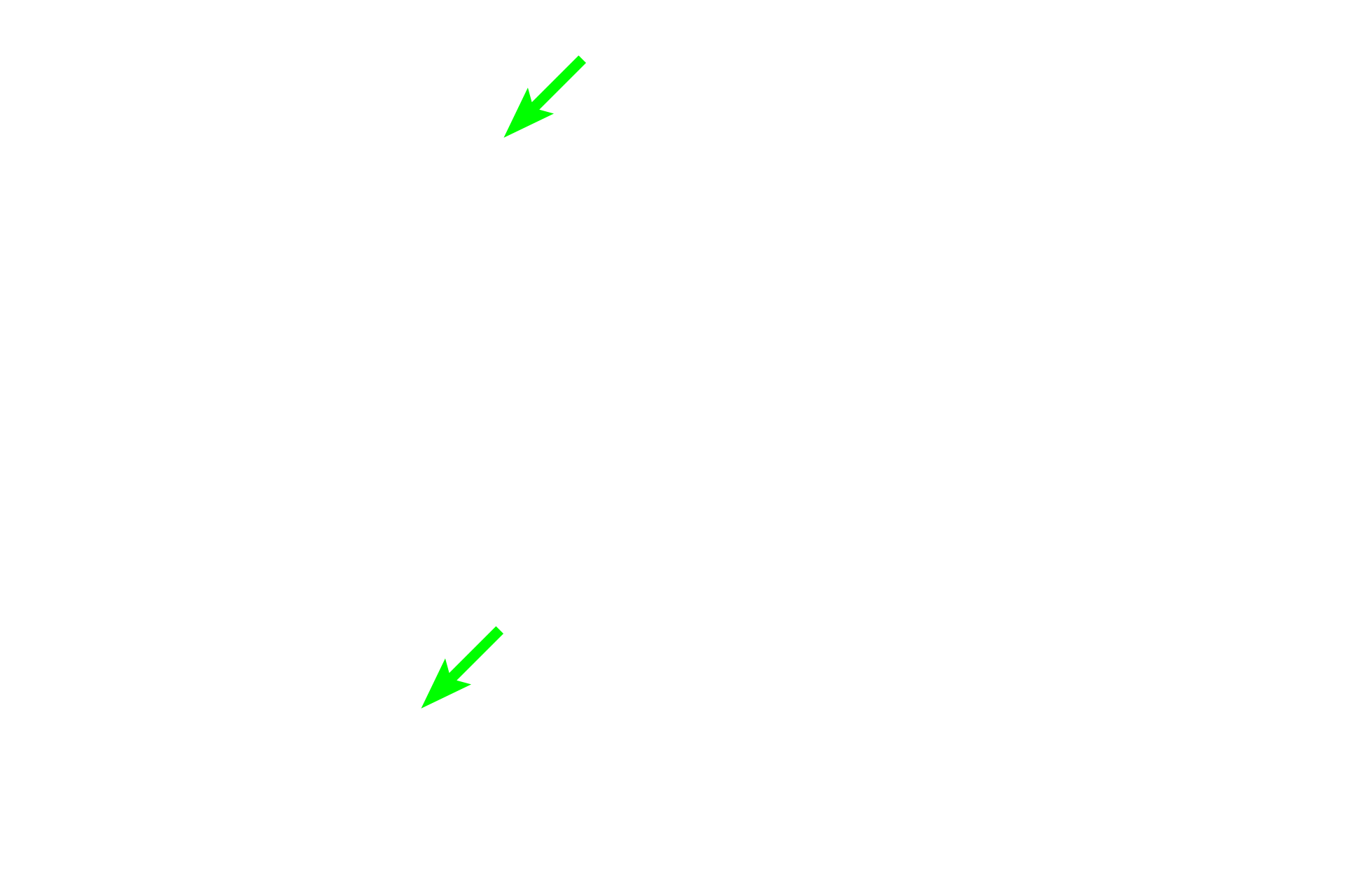  - Cartilage plates <p>This smaller bronchus and its accompanying pulmonary artery are seen in cross section, surrounded by alveoli. The pulmonary artery lies outside the wall of the bronchus.  200x</p>
