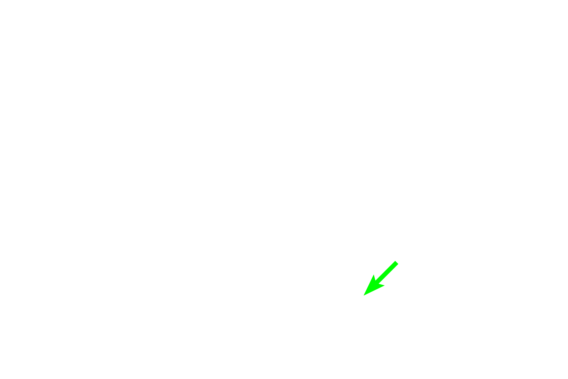 - Bronchial vessel <p>This smaller bronchus and its accompanying pulmonary artery are seen in cross section, surrounded by alveoli. The pulmonary artery lies outside the wall of the bronchus.  200x</p>
