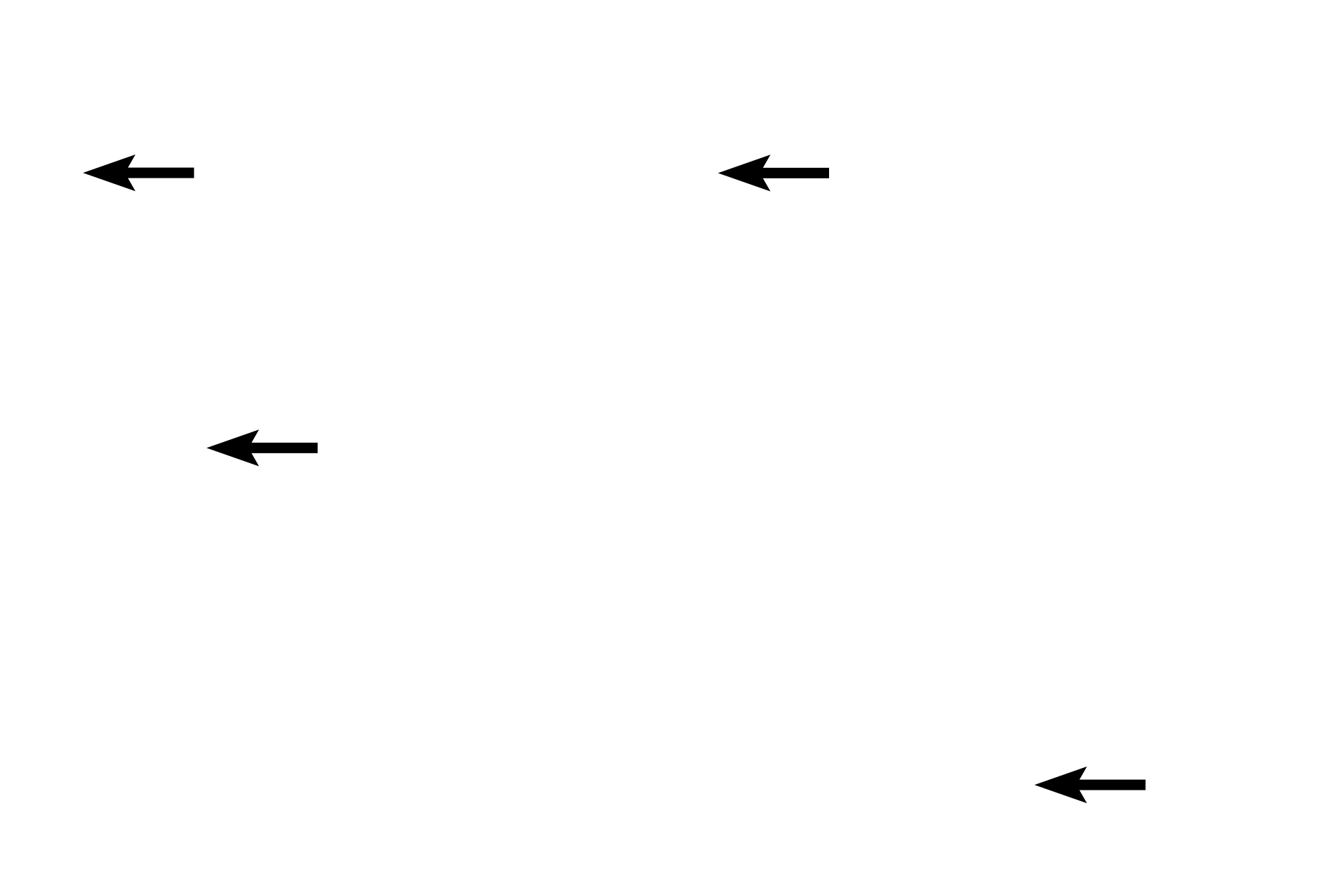 Alveoli <p>This smaller bronchus and its accompanying pulmonary artery are seen in cross section, surrounded by alveoli. The pulmonary artery lies outside the wall of the bronchus.  200x</p>
