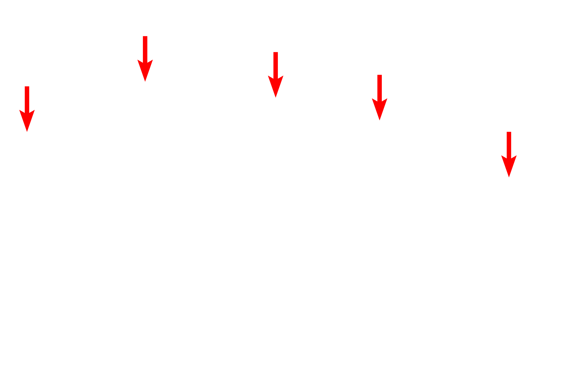 Pulmonary artery <p>A bronchus is shown in longitudinal section with its accompanying pulmonary artery. Pulmonary arteries travel alongside respiratory passageways conveying deoxygenated blood to the alveolar capillaries. Pulmonary arteries branch together with their adjacent respiratory passageways, decreasing in size as they approach the alveoli.  100x</p>
