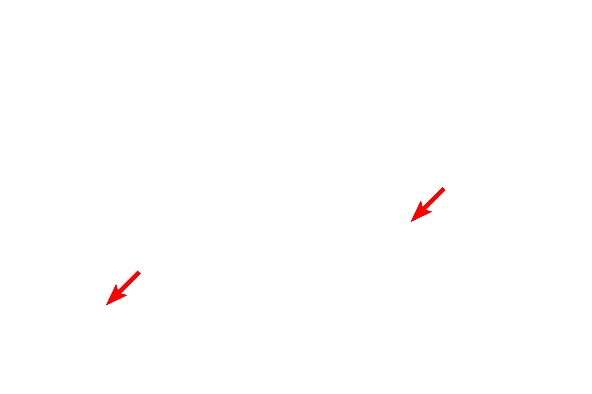  - Cartilage plates <p>A bronchus is shown in longitudinal section with its accompanying pulmonary artery. Pulmonary arteries travel alongside respiratory passageways conveying deoxygenated blood to the alveolar capillaries. Pulmonary arteries branch together with their adjacent respiratory passageways, decreasing in size as they approach the alveoli.  100x</p>
