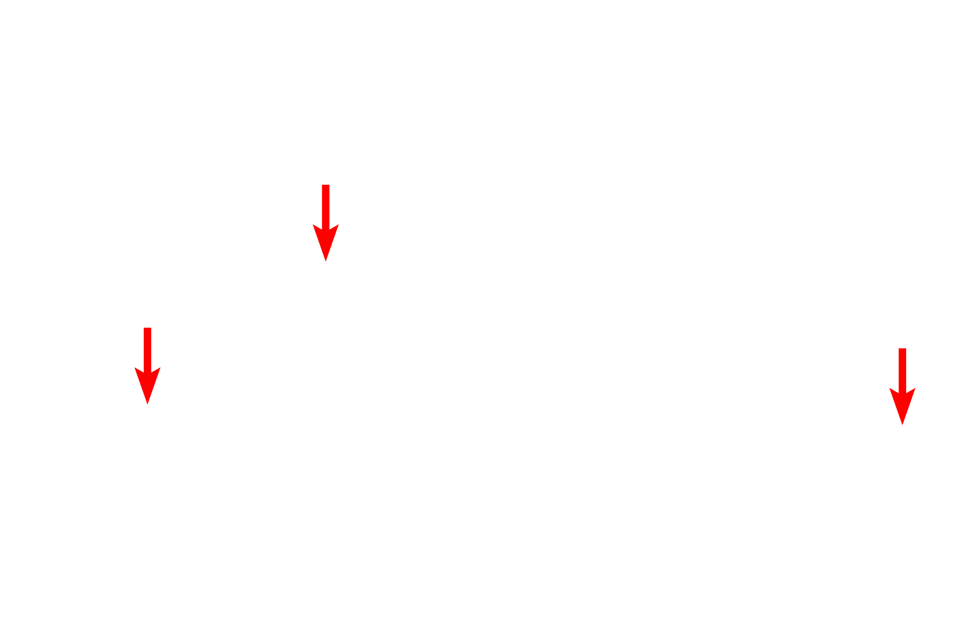  - Mixed glands <p>A bronchus is shown in longitudinal section with its accompanying pulmonary artery. Pulmonary arteries travel alongside respiratory passageways conveying deoxygenated blood to the alveolar capillaries. Pulmonary arteries branch together with their adjacent respiratory passageways, decreasing in size as they approach the alveoli.  100x</p>
